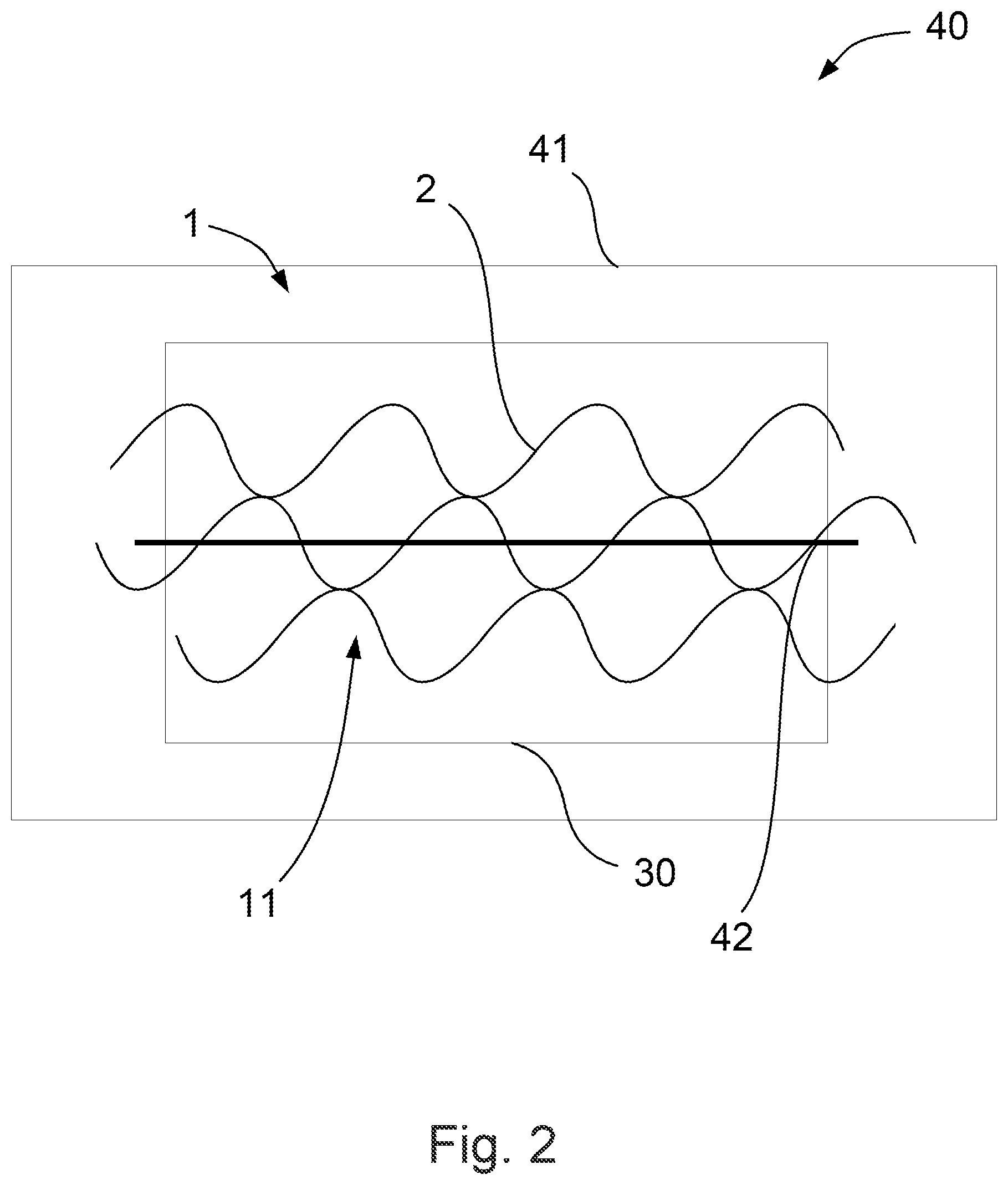 Patent US12311864 Figure 2 – Decorative layer for an interior trim part and interior trim part having the decorative layer