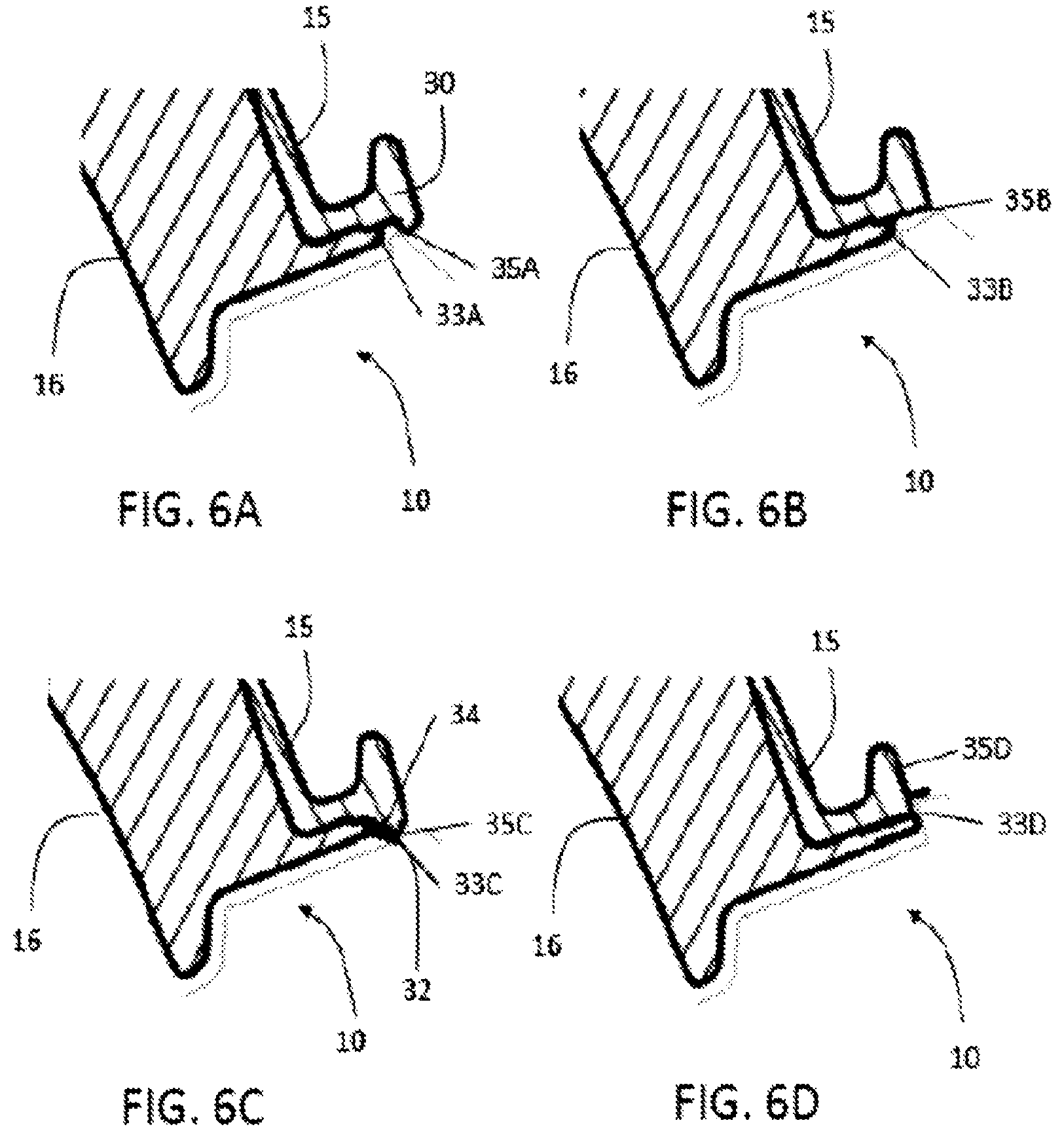 Patent US12312014 Figure 4 – Composite material modular utility vehicle construct