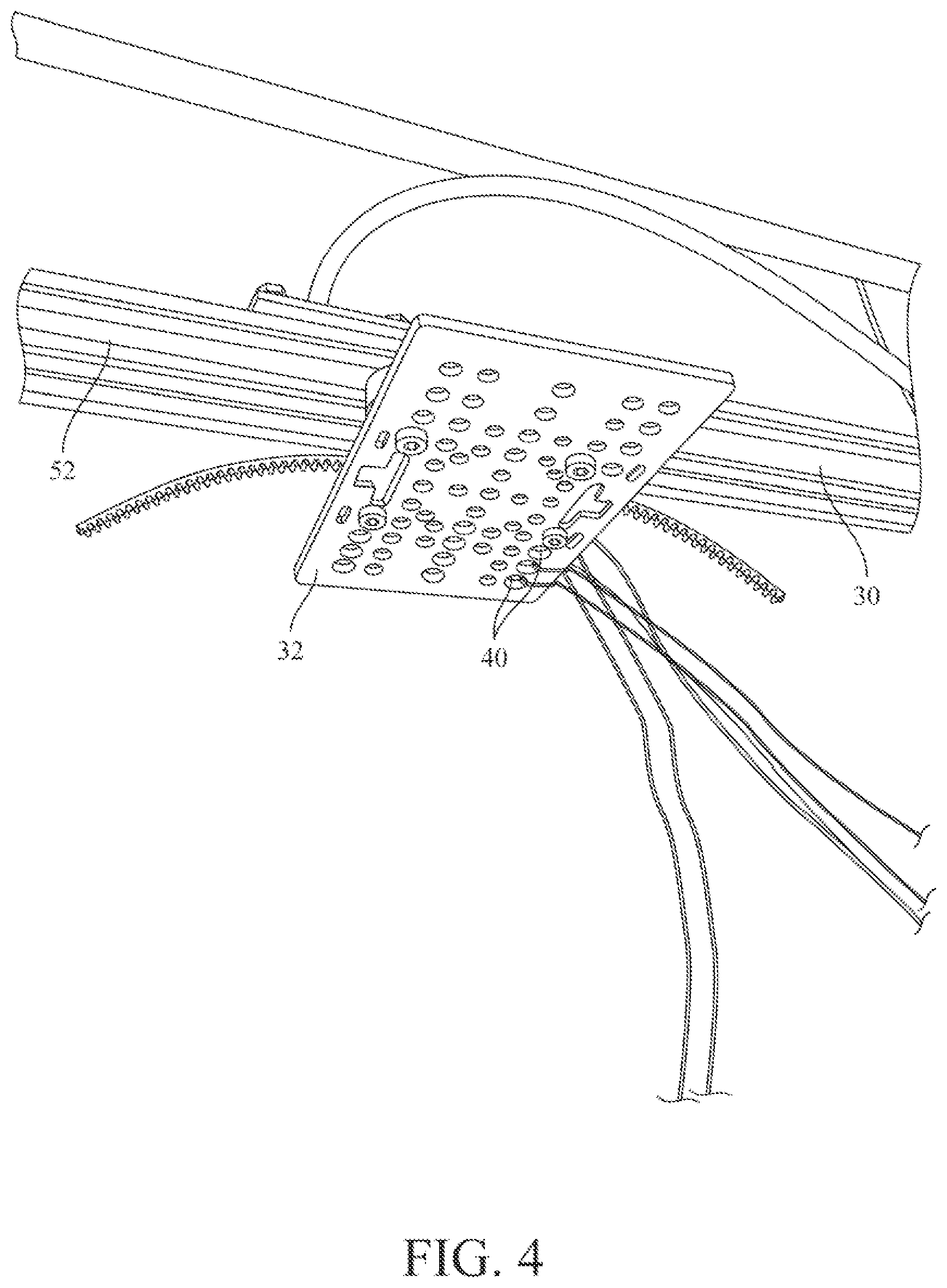 Patent US12312202 Figure 3 – Fiber delivery system