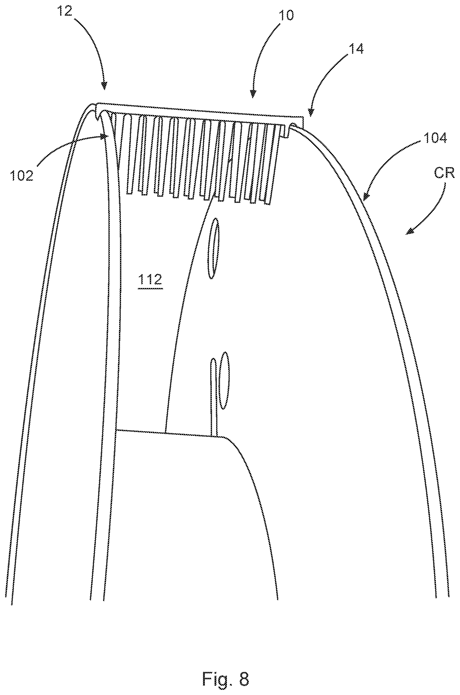 Patent US12312203 Figure 14 – Freely positionable clip line fixture for securing a free end of a clip line to a clip reel
