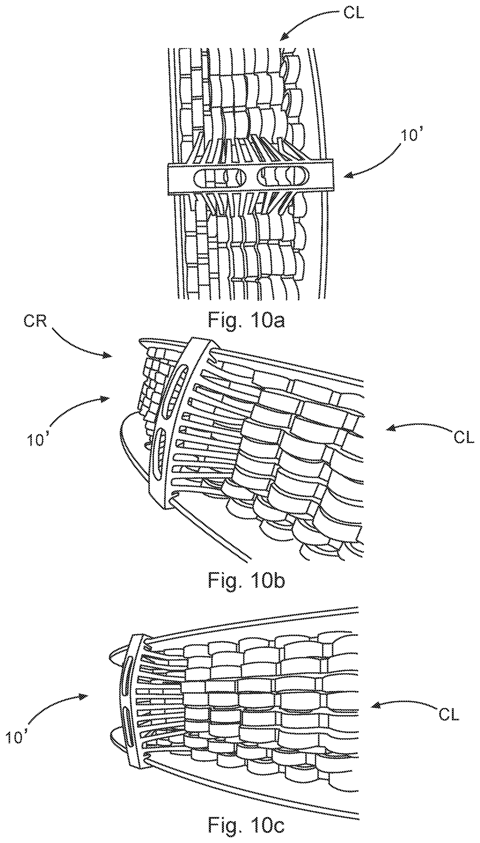 Patent US12312203 Figure 16 – Freely positionable clip line fixture for securing a free end of a clip line to a clip reel