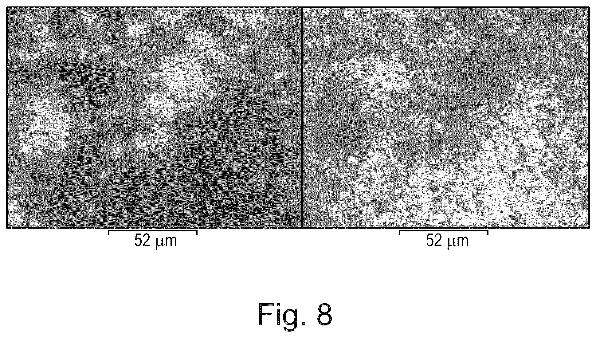 Patent US12312335 Figure 6 – Crystalline pharmaceutically acceptable salt and polymorphic form of the glutaminyl cyclase inhibitor Varoglutamstat