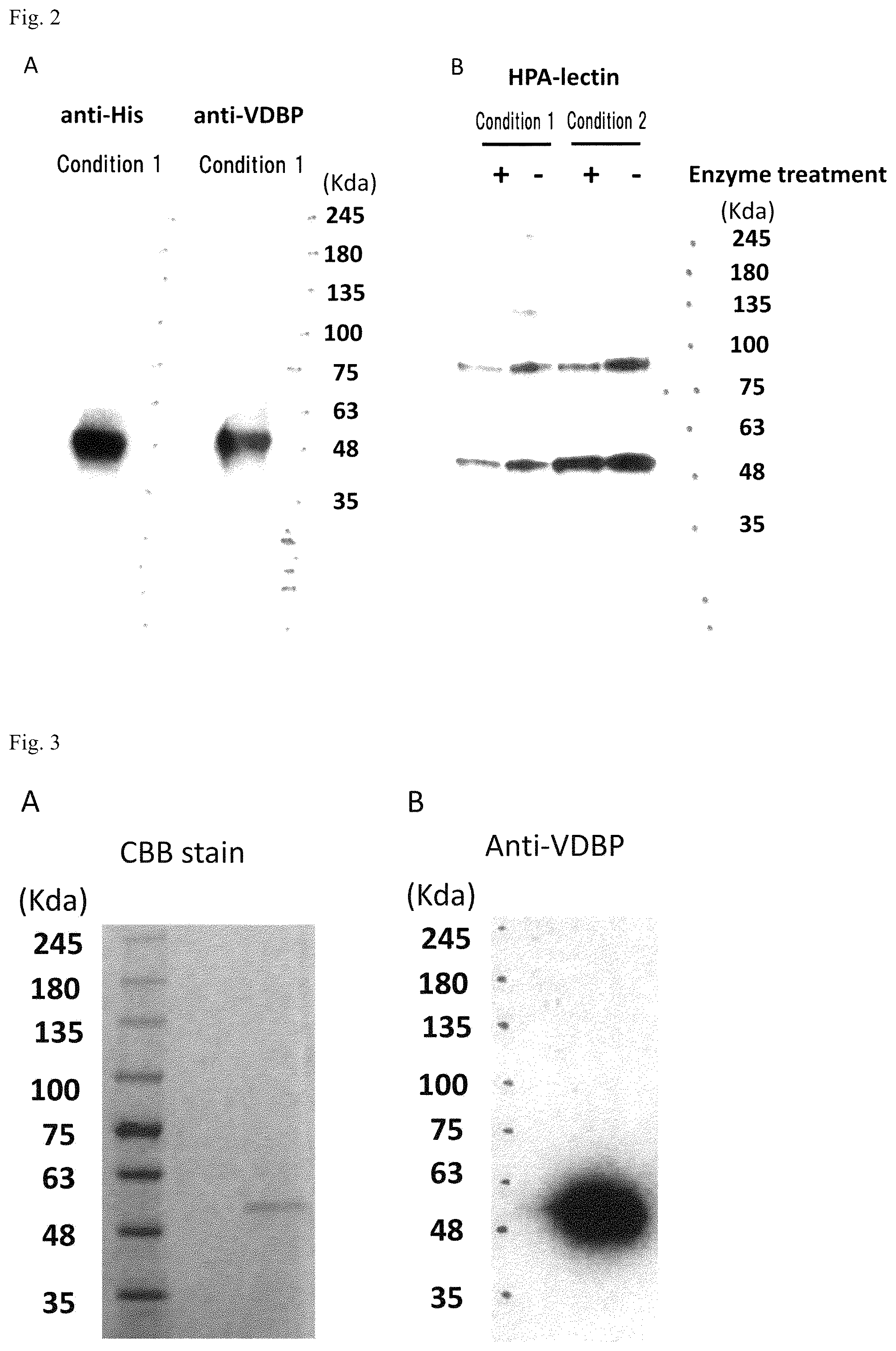Patent US12312380 Figure 2 – Method for producing active GcMAF