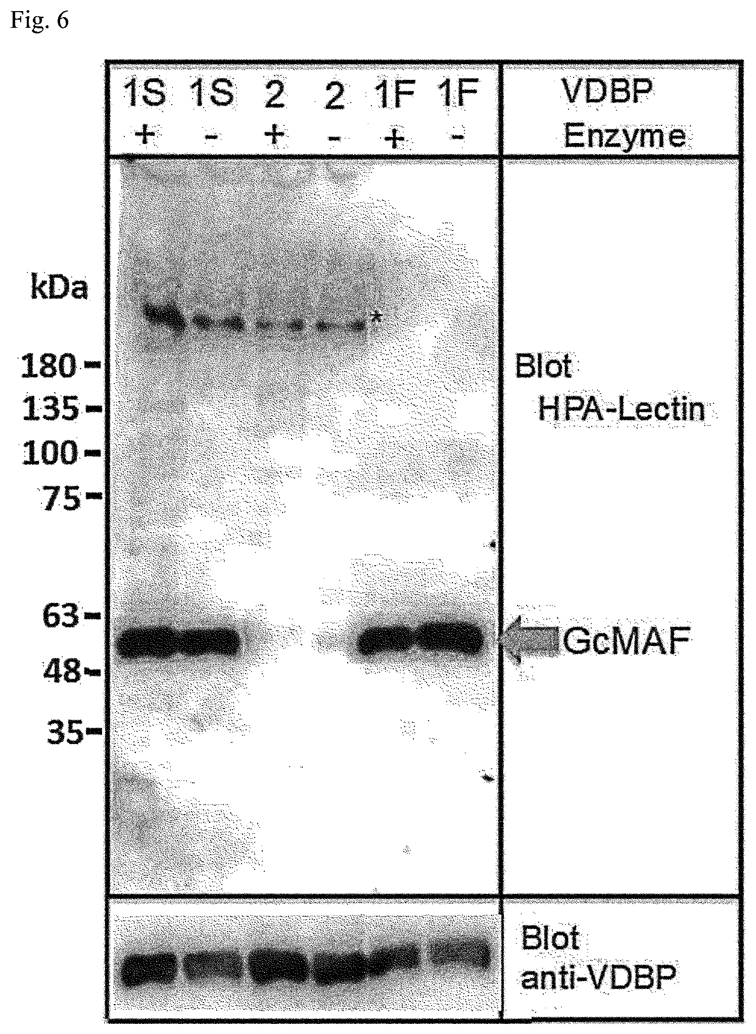 Patent US12312380 Figure 4 – Method for producing active GcMAF