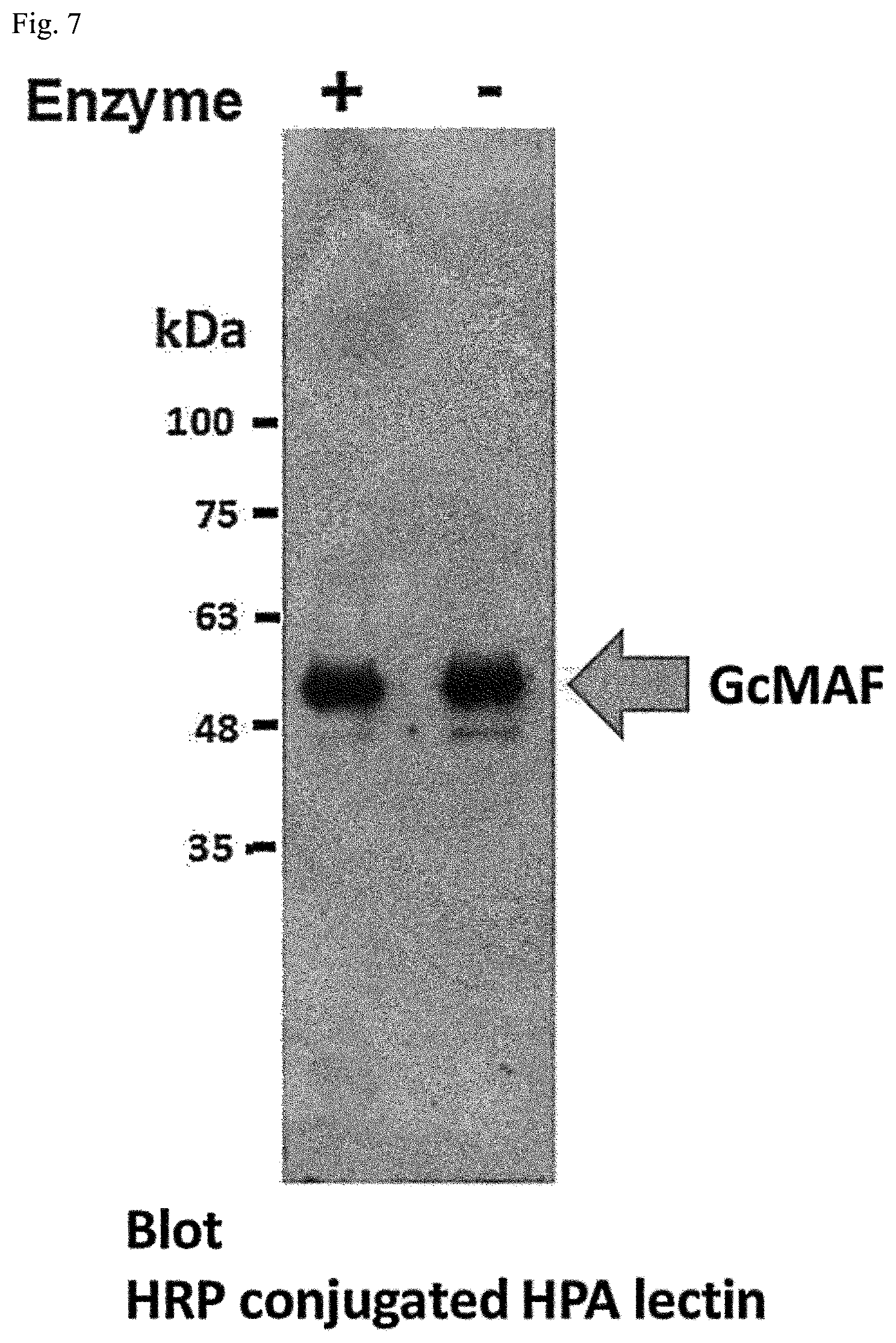 Patent US12312380 Figure 5 – Method for producing active GcMAF