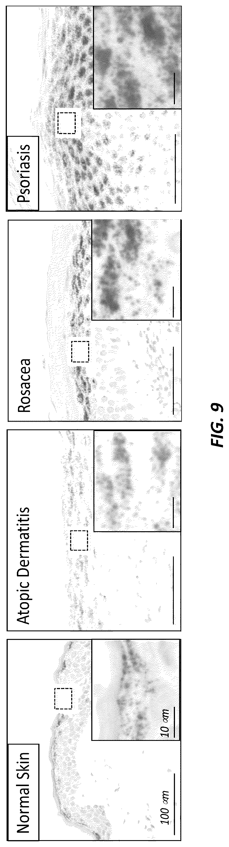 Patent US12312414 Figure 13 – Anti-KLK7 antibodies, anti-KLK5 antibodies, multispecific anti-KLK5/KLK7 antibodies, and methods of use