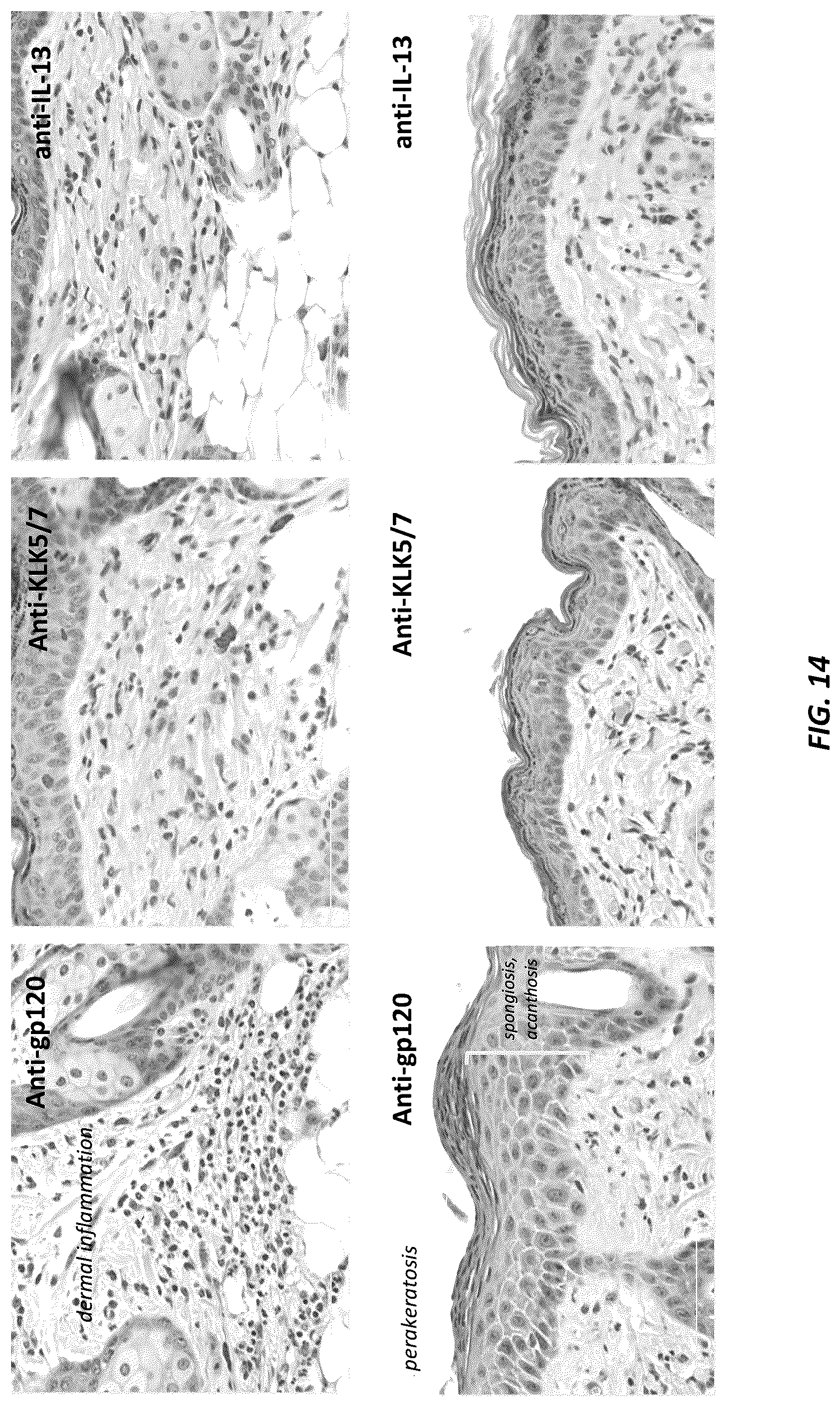 Patent US12312414 Figure 18 – Anti-KLK7 antibodies, anti-KLK5 antibodies, multispecific anti-KLK5/KLK7 antibodies, and methods of use