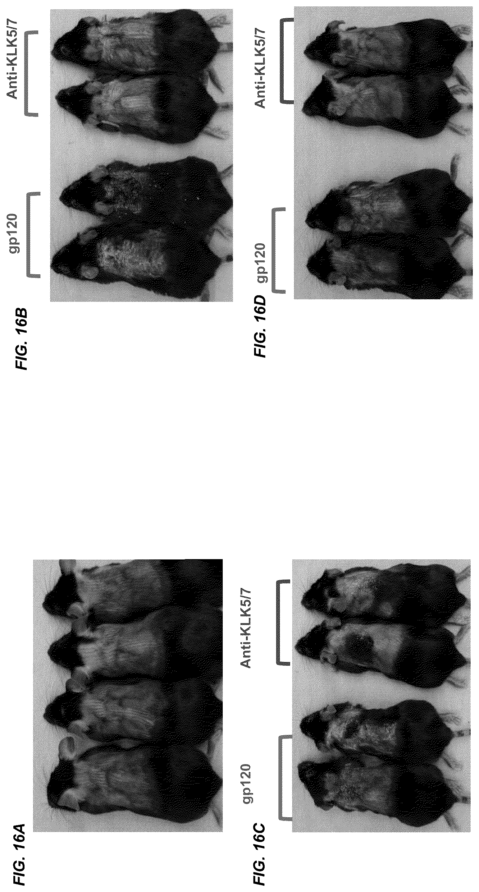 Patent US12312414 Figure 20 – Anti-KLK7 antibodies, anti-KLK5 antibodies, multispecific anti-KLK5/KLK7 antibodies, and methods of use