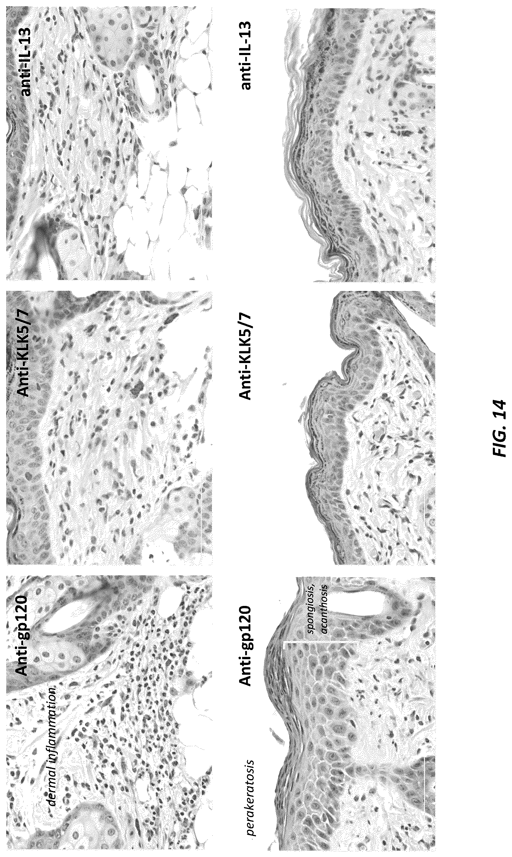 Patent US12312415 Figure 18 – Anti-KLK7 antibodies, anti-KLK5 antibodies, multispecific anti-KLK5/KLK7 antibodies, and methods of use