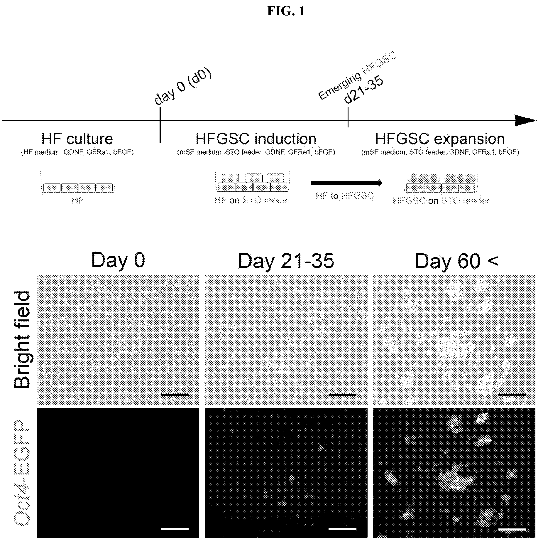 Patent US12312596 Figure 1 – Method of transdifferentiating hair follicle stem cells into sperm stem cells