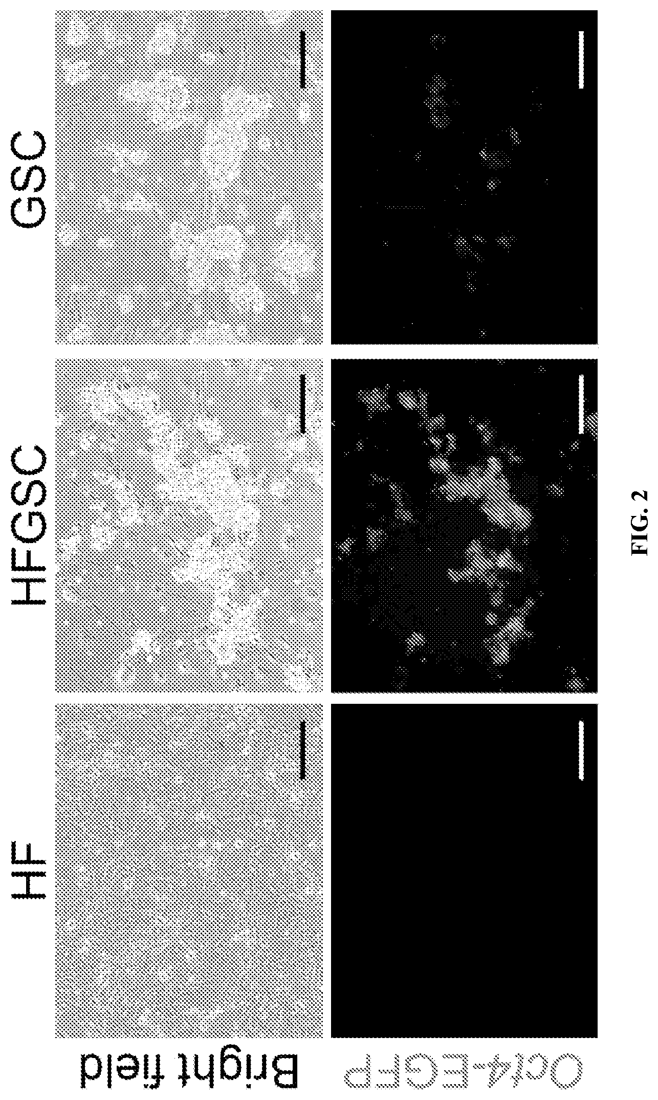 Patent US12312596 Figure 2 – Method of transdifferentiating hair follicle stem cells into sperm stem cells