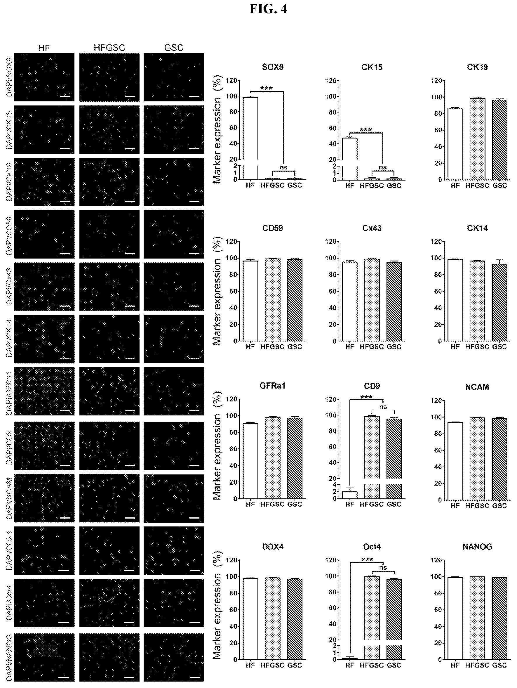 Patent US12312596 Figure 4 – Method of transdifferentiating hair follicle stem cells into sperm stem cells