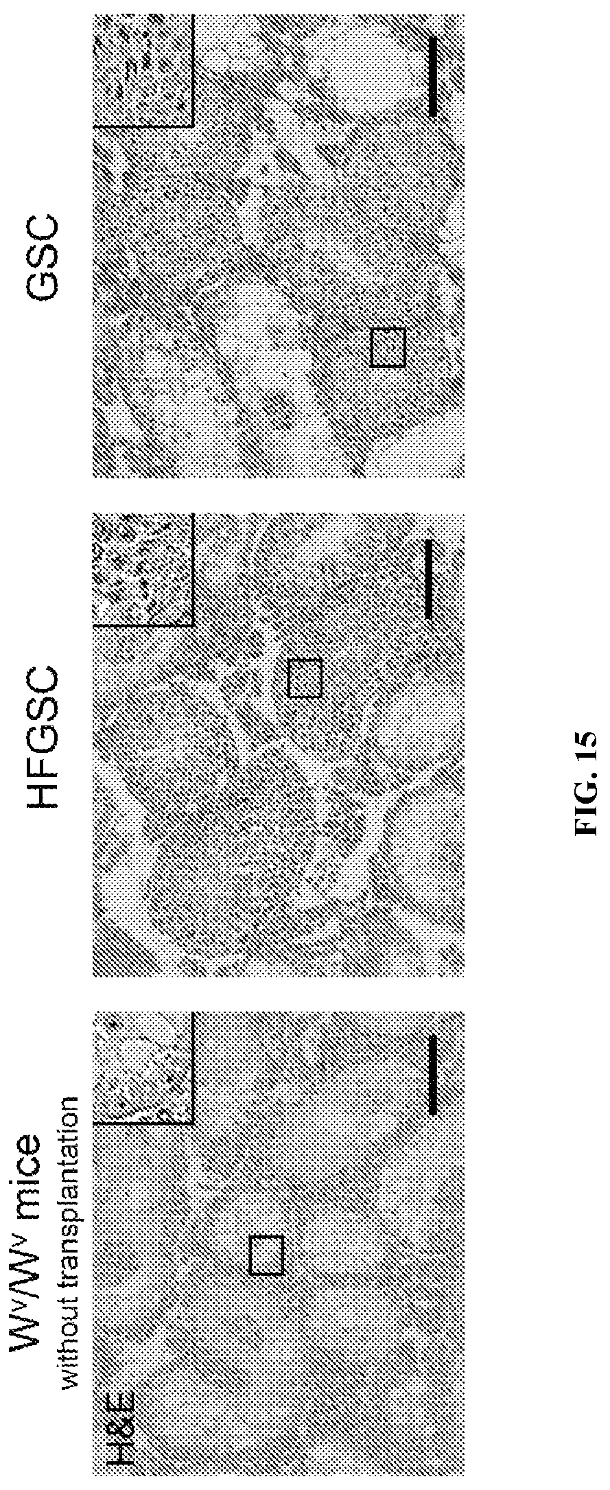 Patent US12312596 Figure 15 – Method of transdifferentiating hair follicle stem cells into sperm stem cells