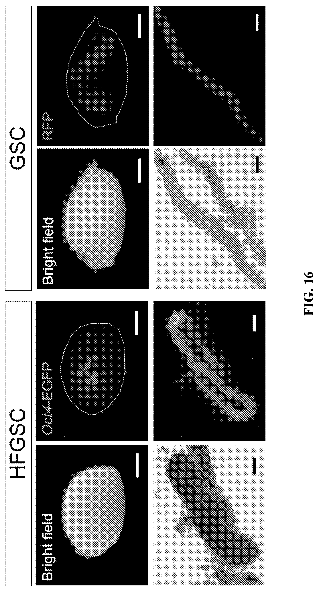 Patent US12312596 Figure 16 – Method of transdifferentiating hair follicle stem cells into sperm stem cells