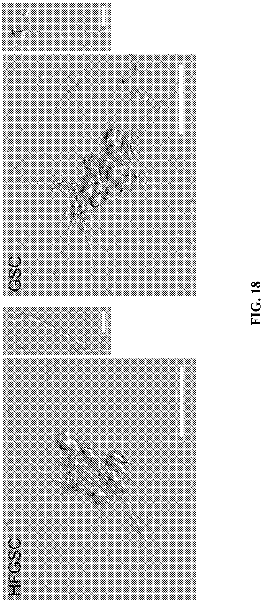Patent US12312596 Figure 18 – Method of transdifferentiating hair follicle stem cells into sperm stem cells