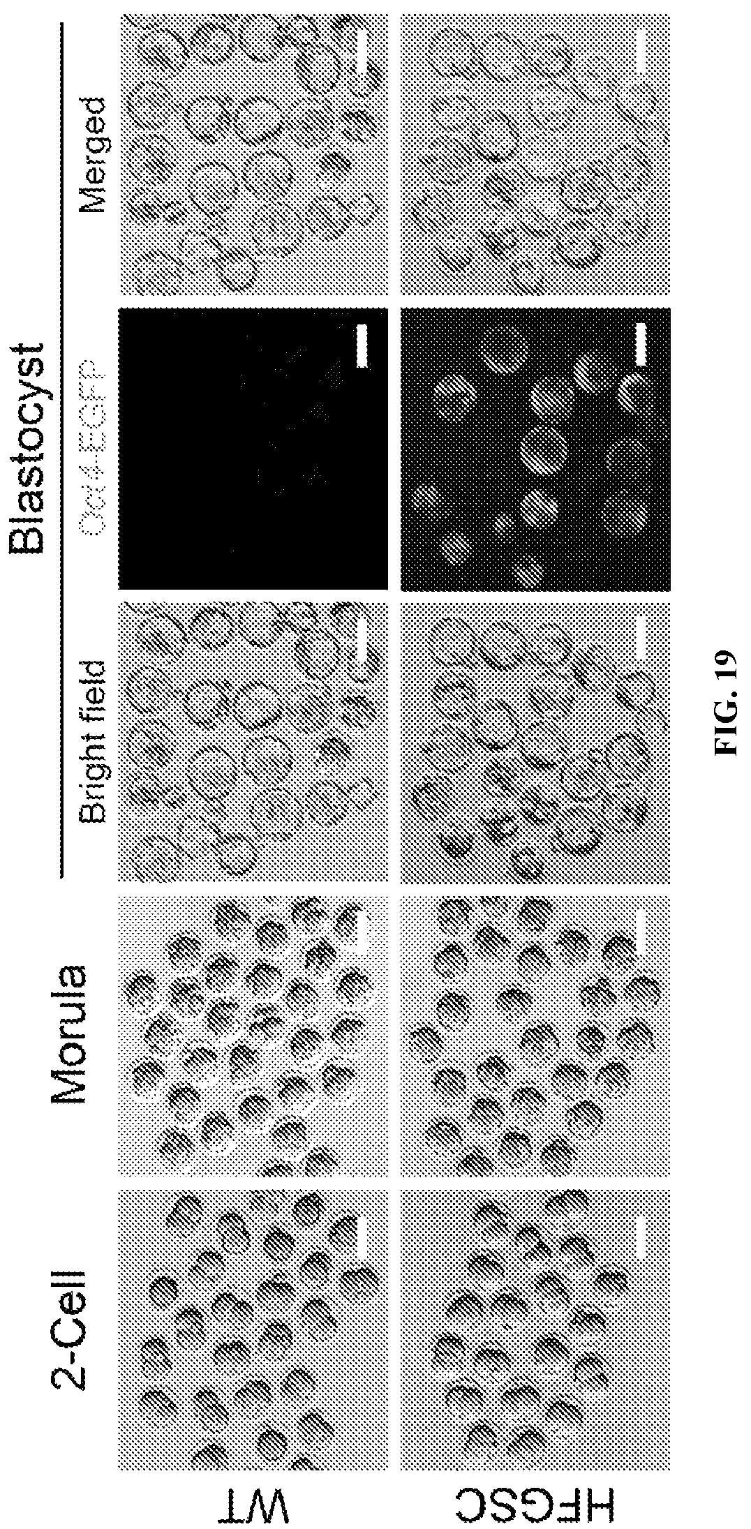 Patent US12312596 Figure 19 – Method of transdifferentiating hair follicle stem cells into sperm stem cells