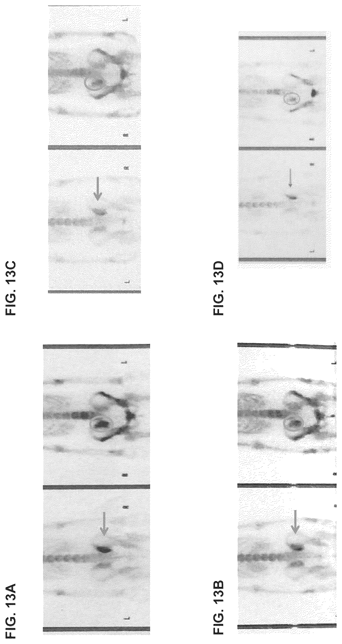 Patent US12312597 Figure 18 – Methods of cancer treatment using activated t cells