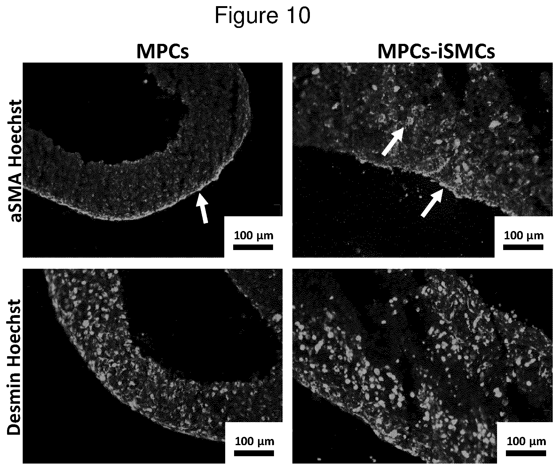 Patent US12312600 Figure 10 – Methods for obtaining induced smooth muscle cells