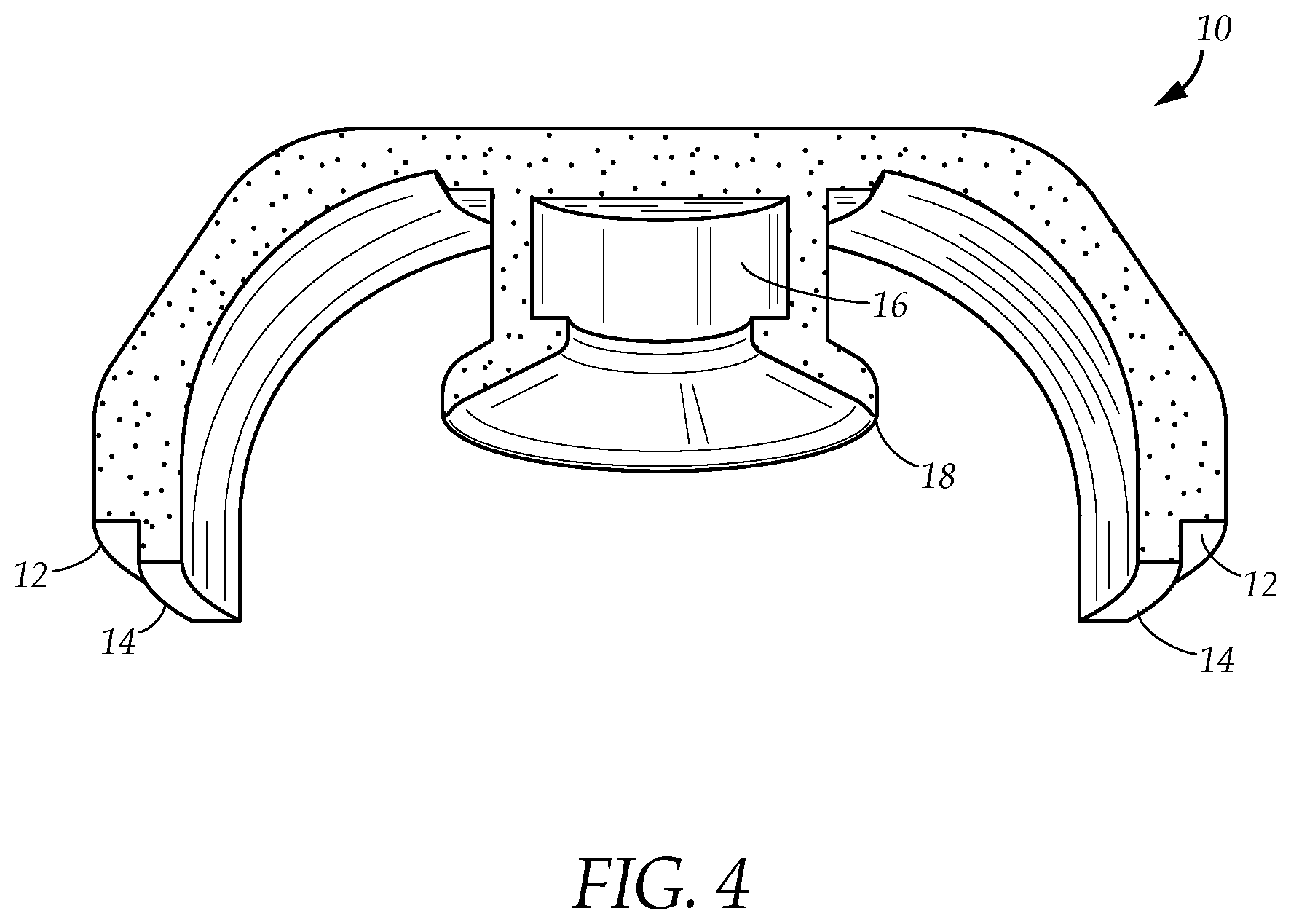 Patent US12312602 Figure 4 – Apparatus and method for harvesting and preparing viable stem cells