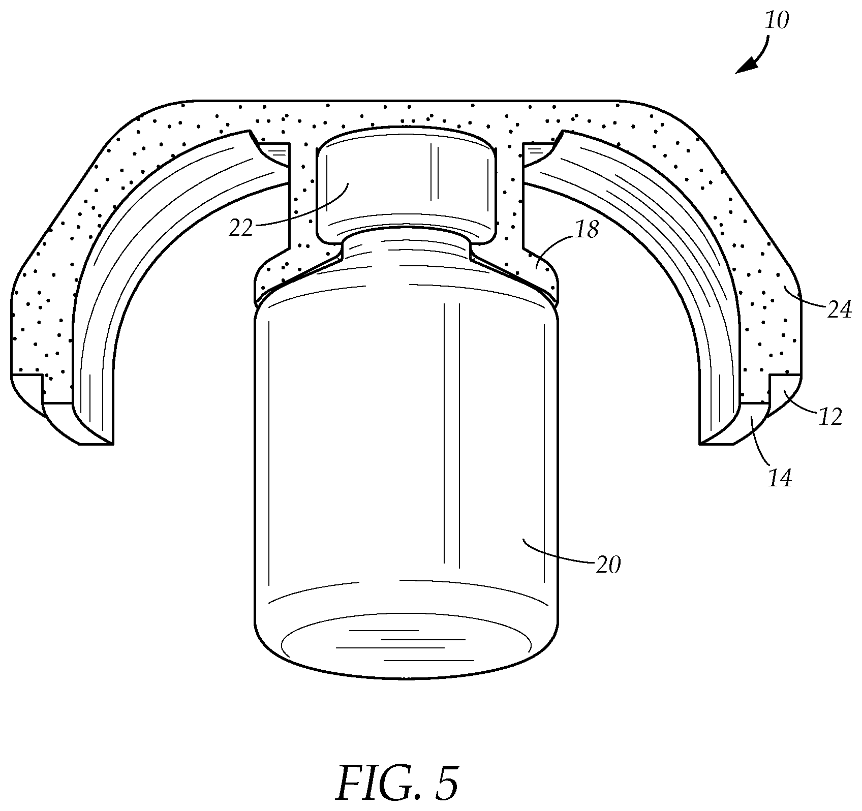 Patent US12312602 Figure 5 – Apparatus and method for harvesting and preparing viable stem cells