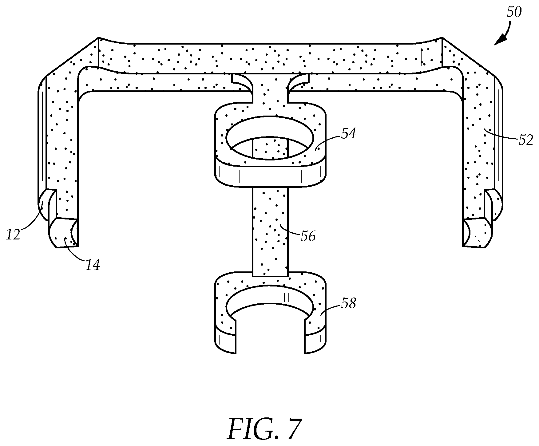 Patent US12312602 Figure 7 – Apparatus and method for harvesting and preparing viable stem cells