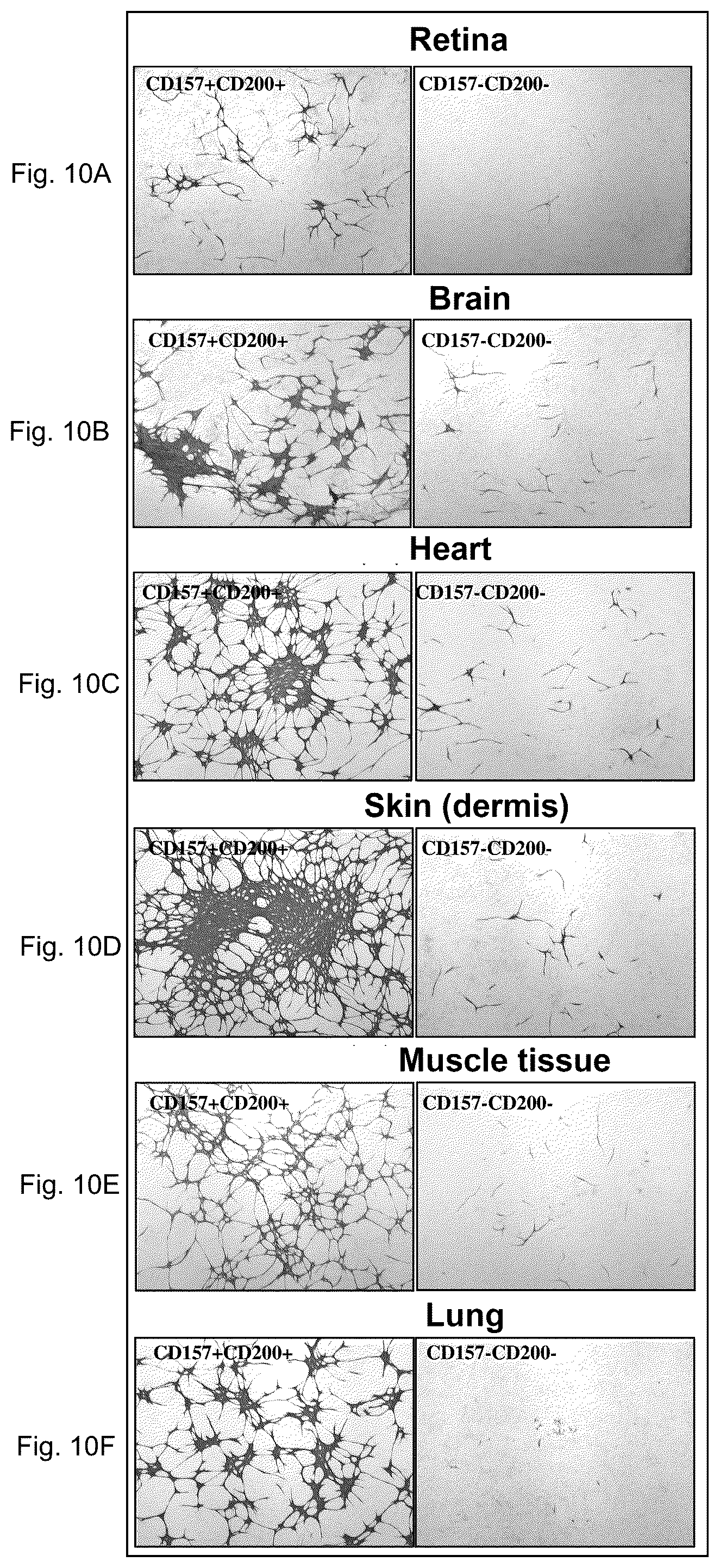 Patent US12312603 Figure 5 – Cell populations of CD31-positive, CD45-negative, CD200-positive mammalian cells and use thereof
