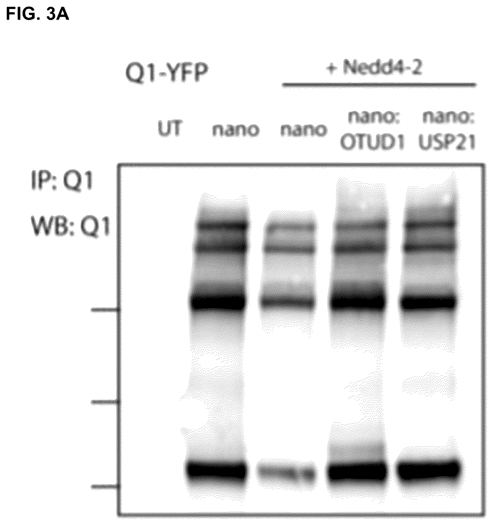 Patent US12312618 Figure 3 – Compositions and methods for using engineered deubiquitinases for probing ubiquitin-dependent cellular processes