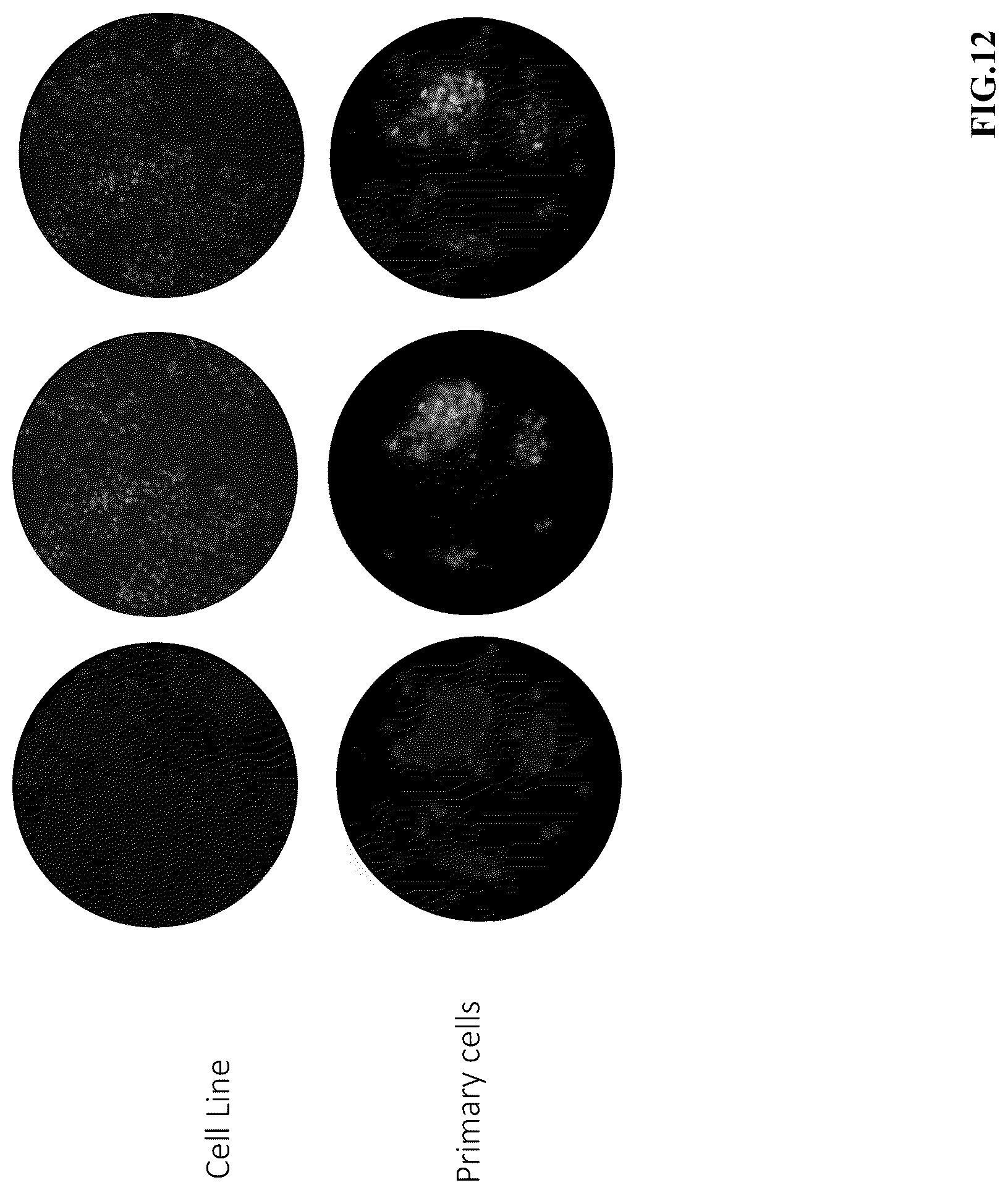 Patent US12312631 Figure 14 – High-throughput multiplexed sensitivity and resistance assay