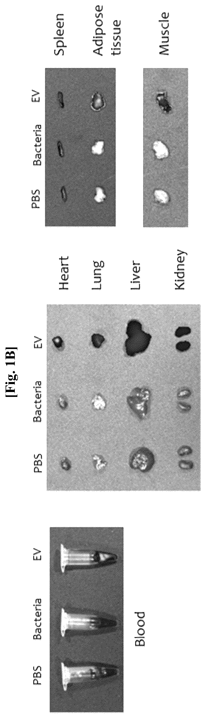 Patent US12312636 Figure 2 – Nanovesicles derived from genus Bacillus bacteria and use thereof