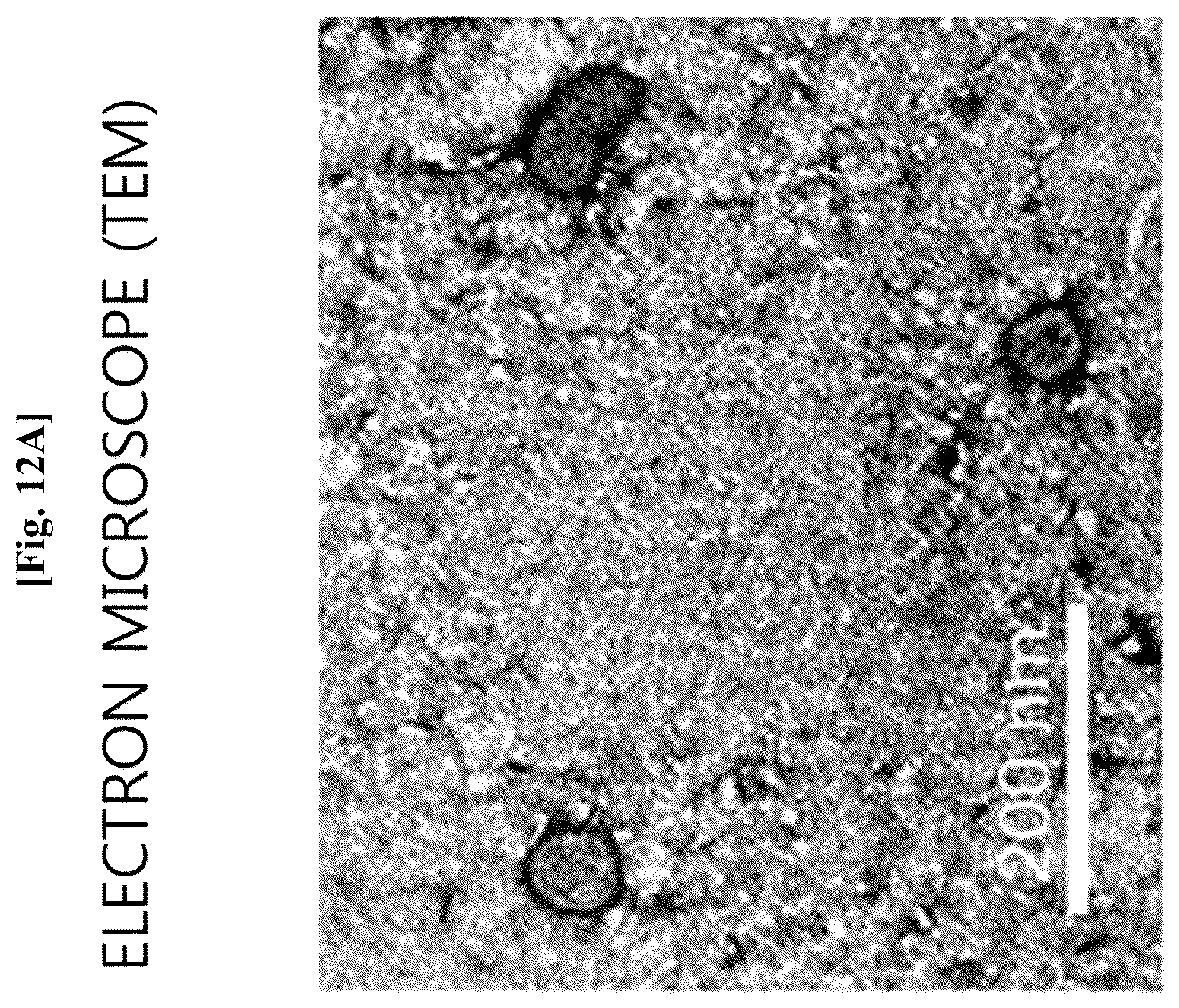 Patent US12312636 Figure 13 – Nanovesicles derived from genus Bacillus bacteria and use thereof