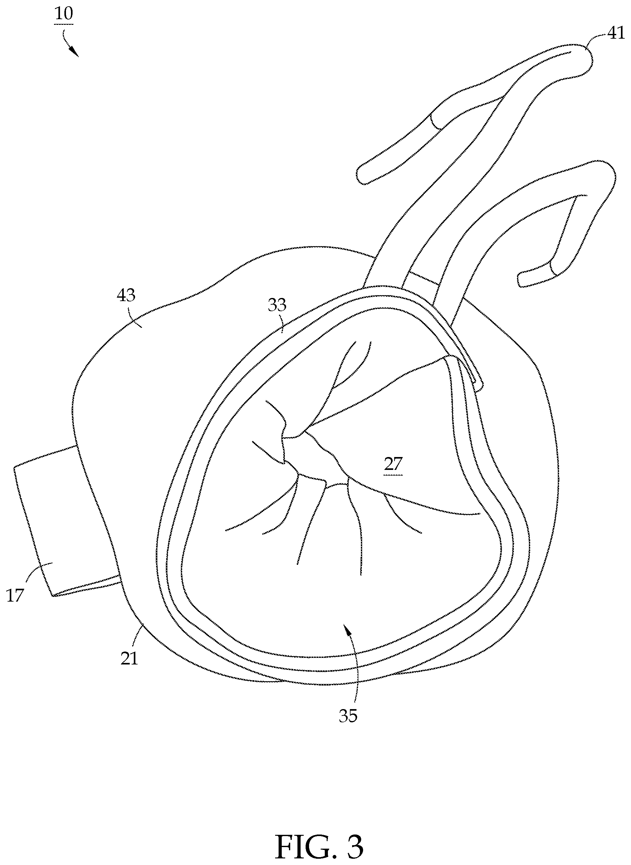Patent US12312743 Figure 3 – Knot protector