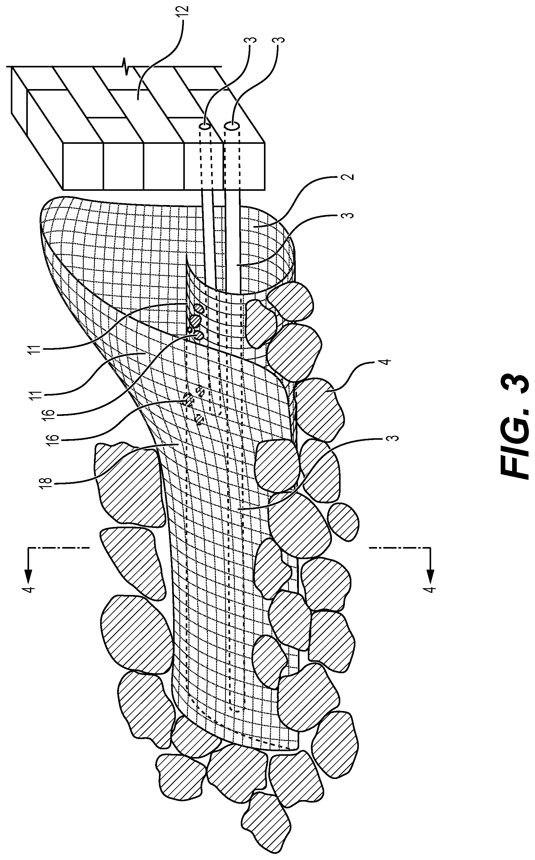 Patent US12312762 Figure 3 – Grout tube protection system