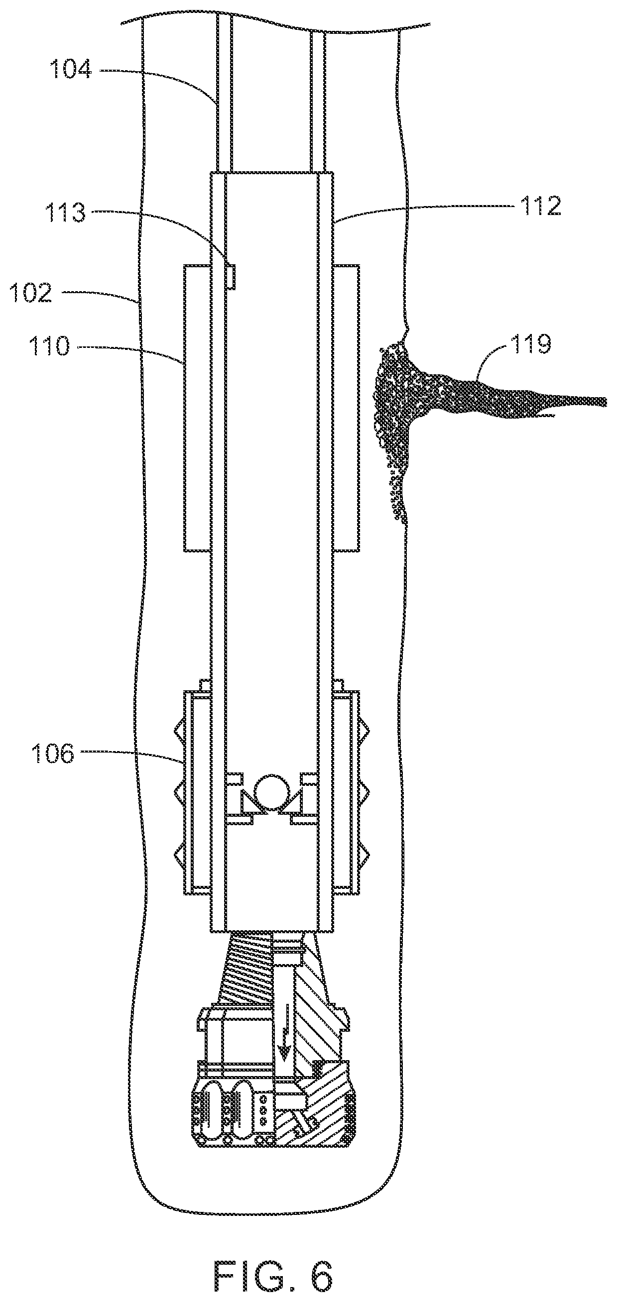 Patent US12312885 Figure 6 – Reducing fluid loss with lost circulation materials