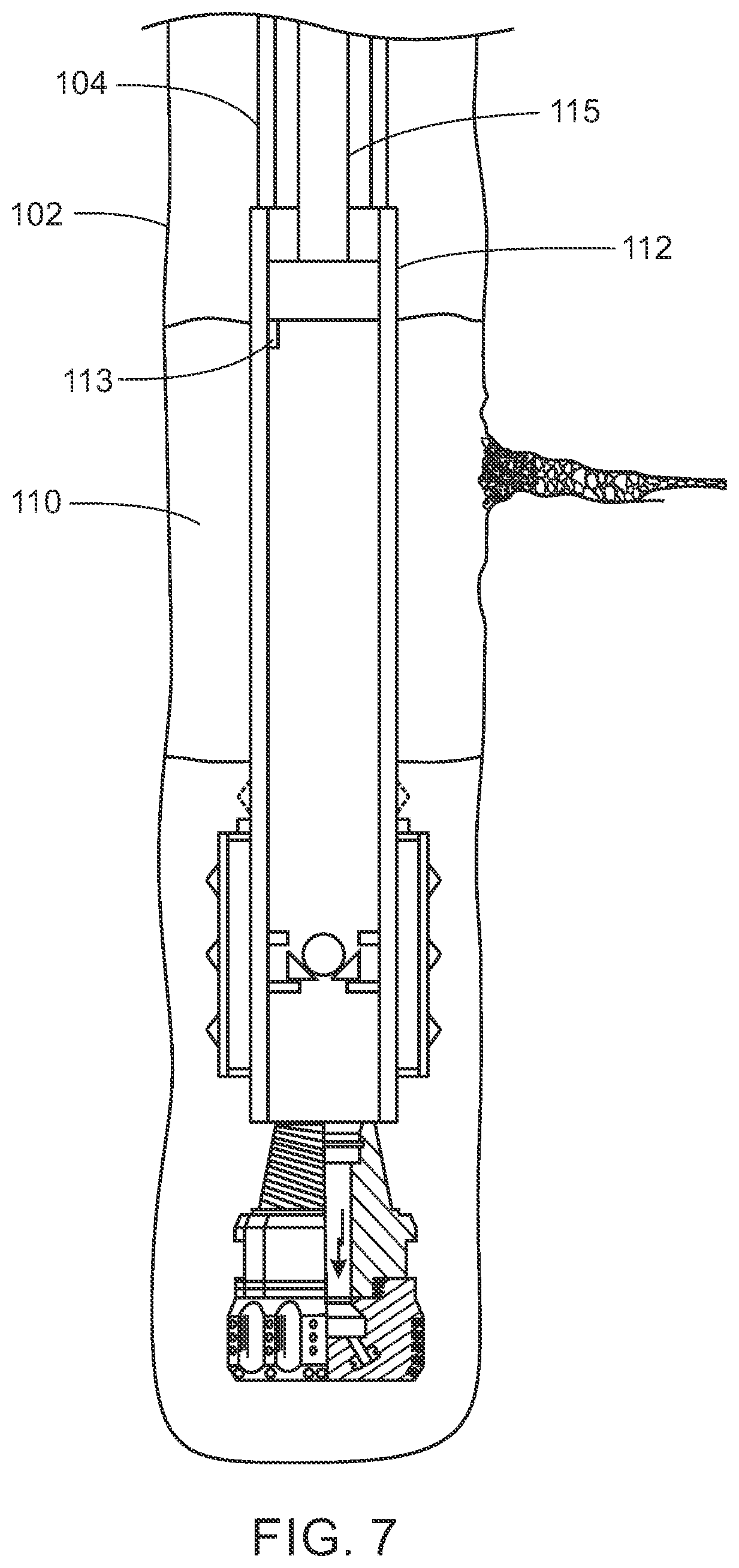 Patent US12312885 Figure 7 – Reducing fluid loss with lost circulation materials