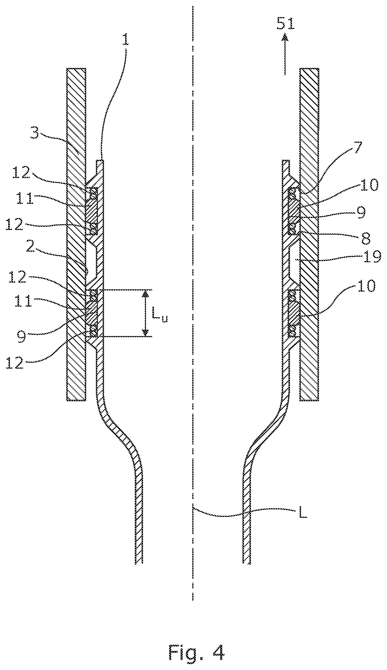 Patent US12312901 Figure 4 – Downhole expandable tubular