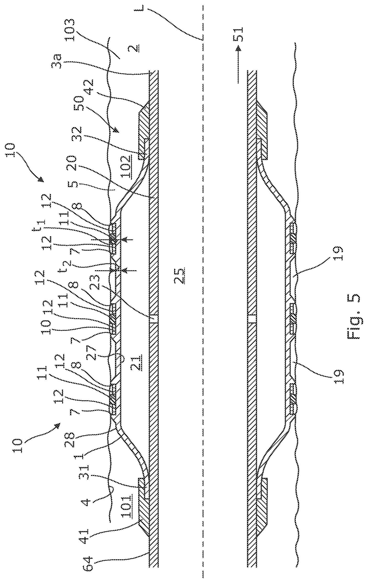 Patent US12312901 Figure 5 – Downhole expandable tubular