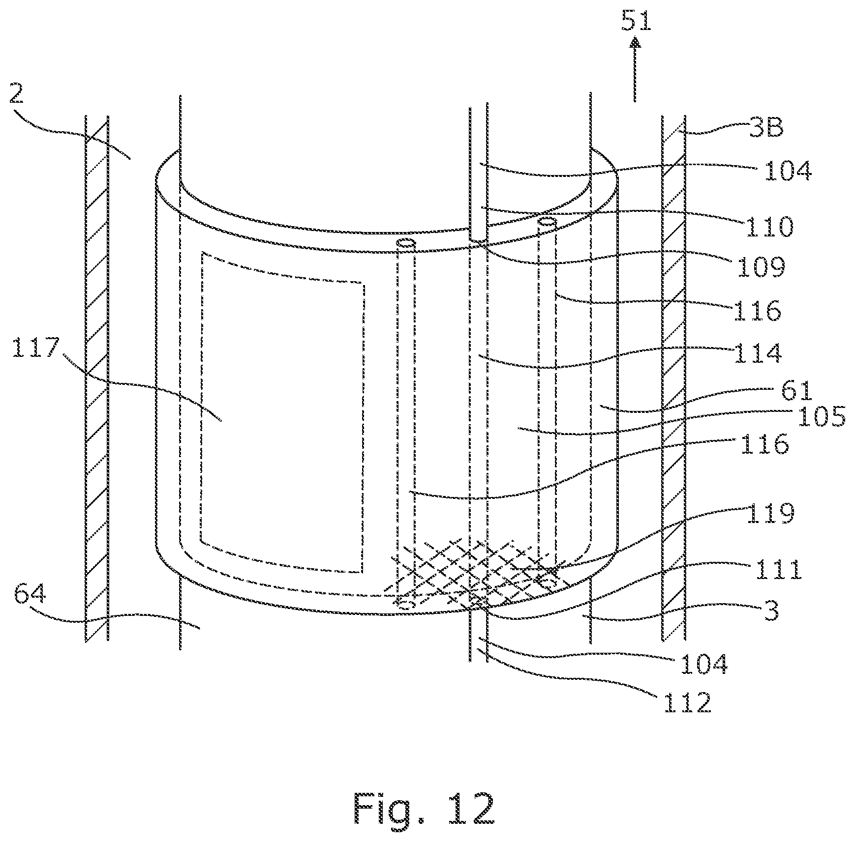 Patent US12312901 Figure 11 – Downhole expandable tubular