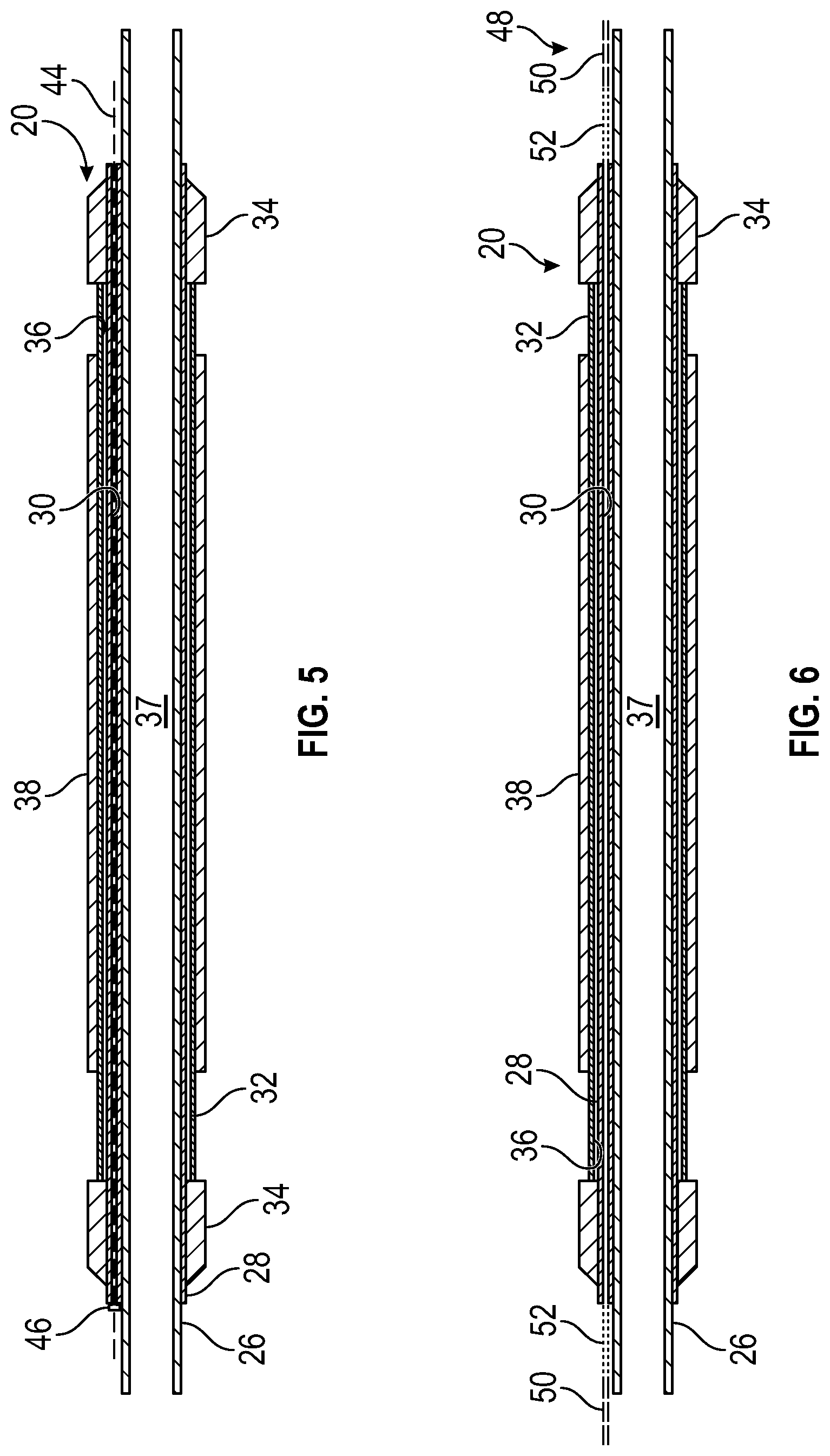 Patent US12312902 Figure 3 – System and methodology for providing bypass through an expandable metal packer