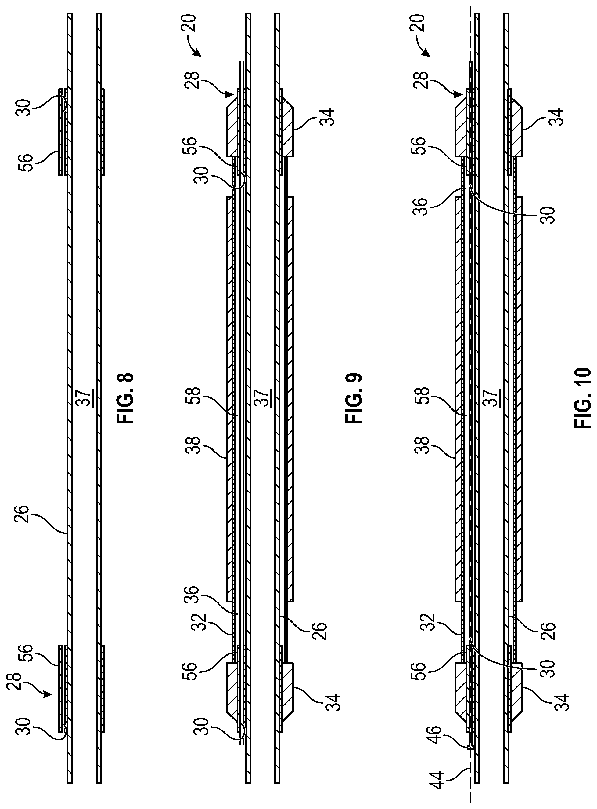 Patent US12312902 Figure 5 – System and methodology for providing bypass through an expandable metal packer