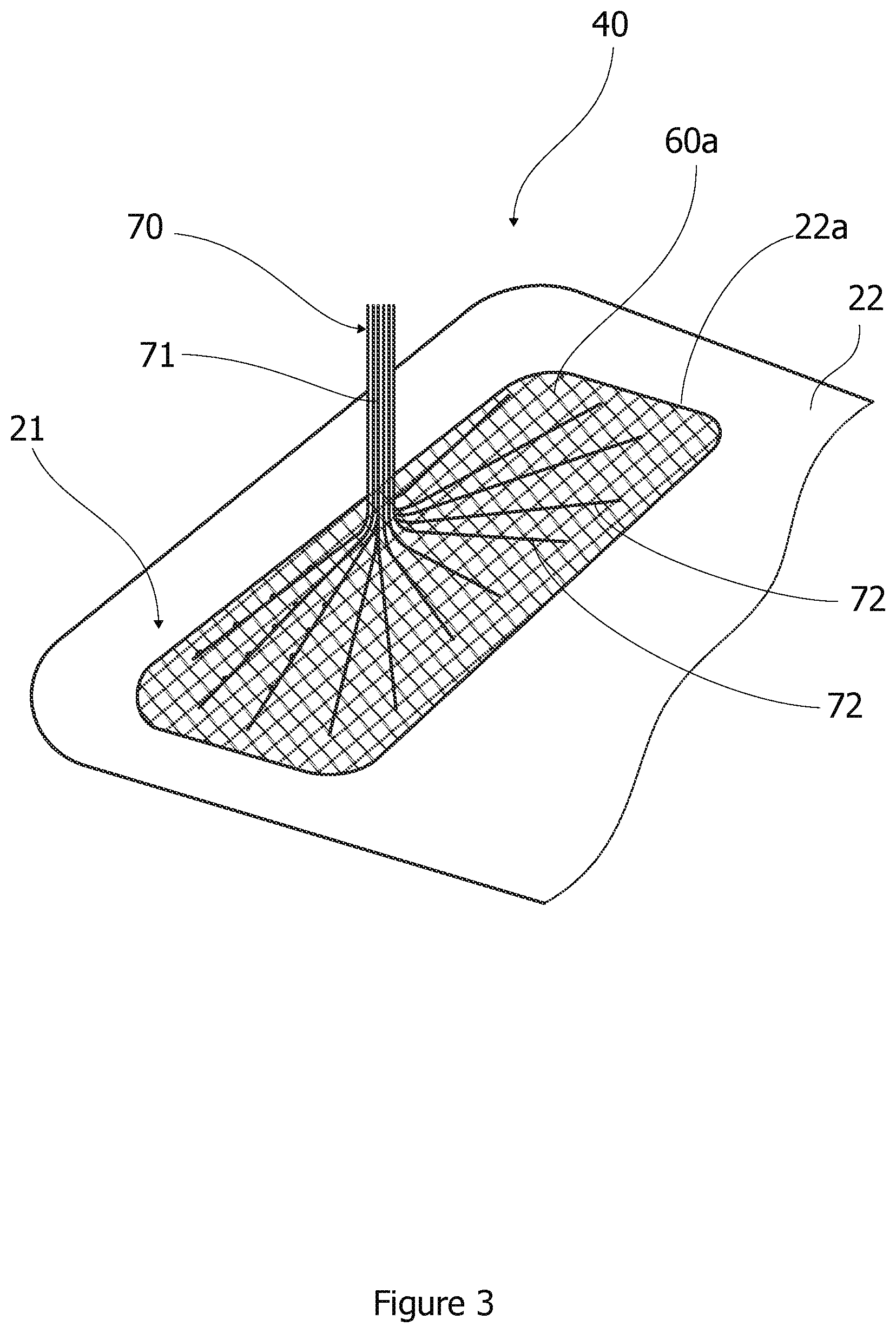 Patent US12313039 Figure 3 – Wind turbine blade having a de-icing system