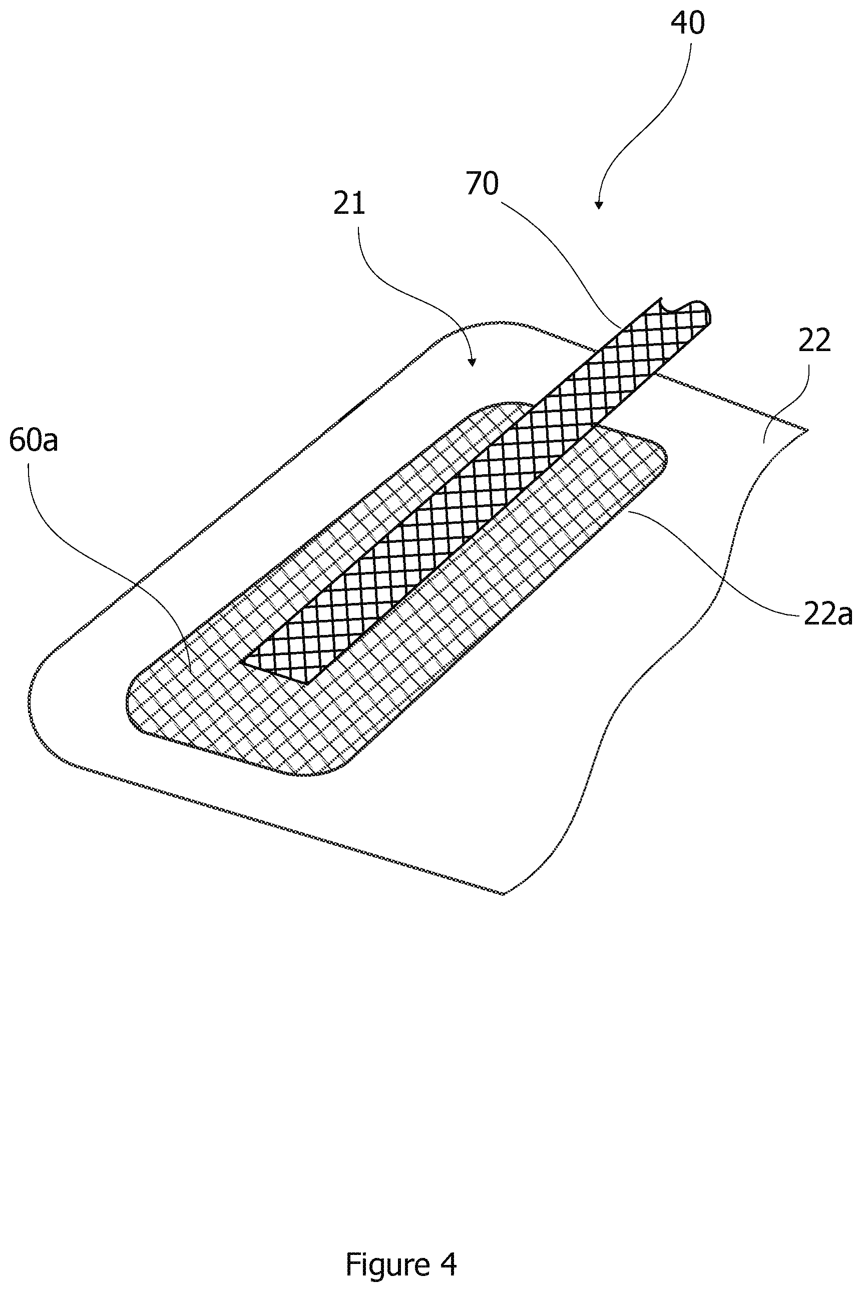Patent US12313039 Figure 4 – Wind turbine blade having a de-icing system