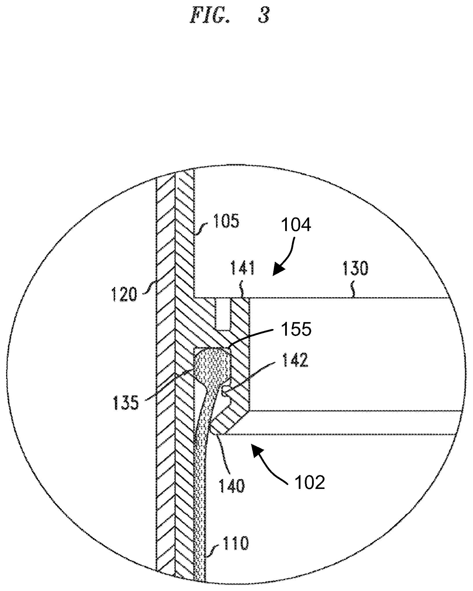 Patent US12313090 Figure 3 – Hydro-pneumatic pressure vessel and diaphragm assembly method