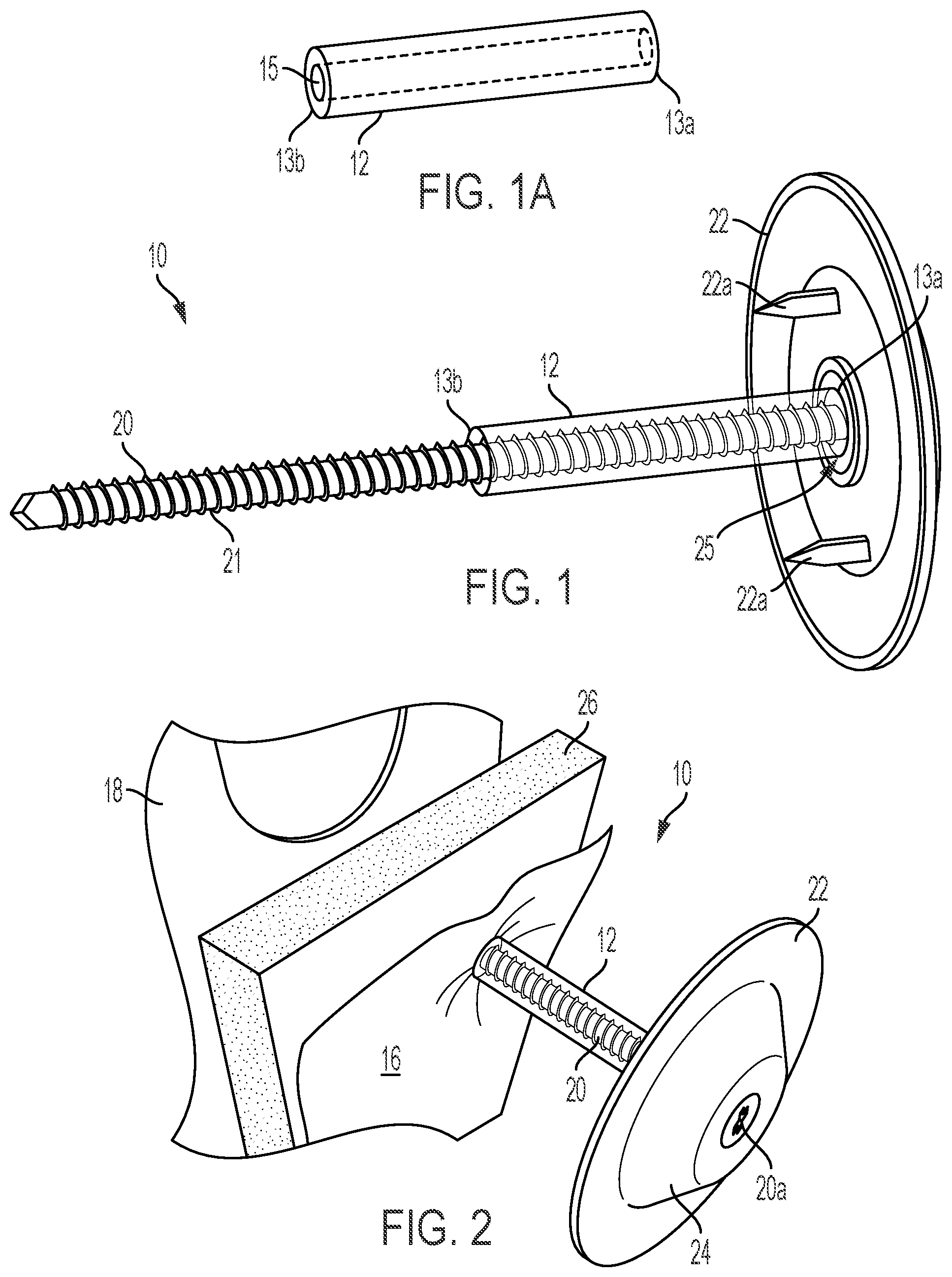 Patent US12313111 Figure 1 – Wall system fastener with seal member