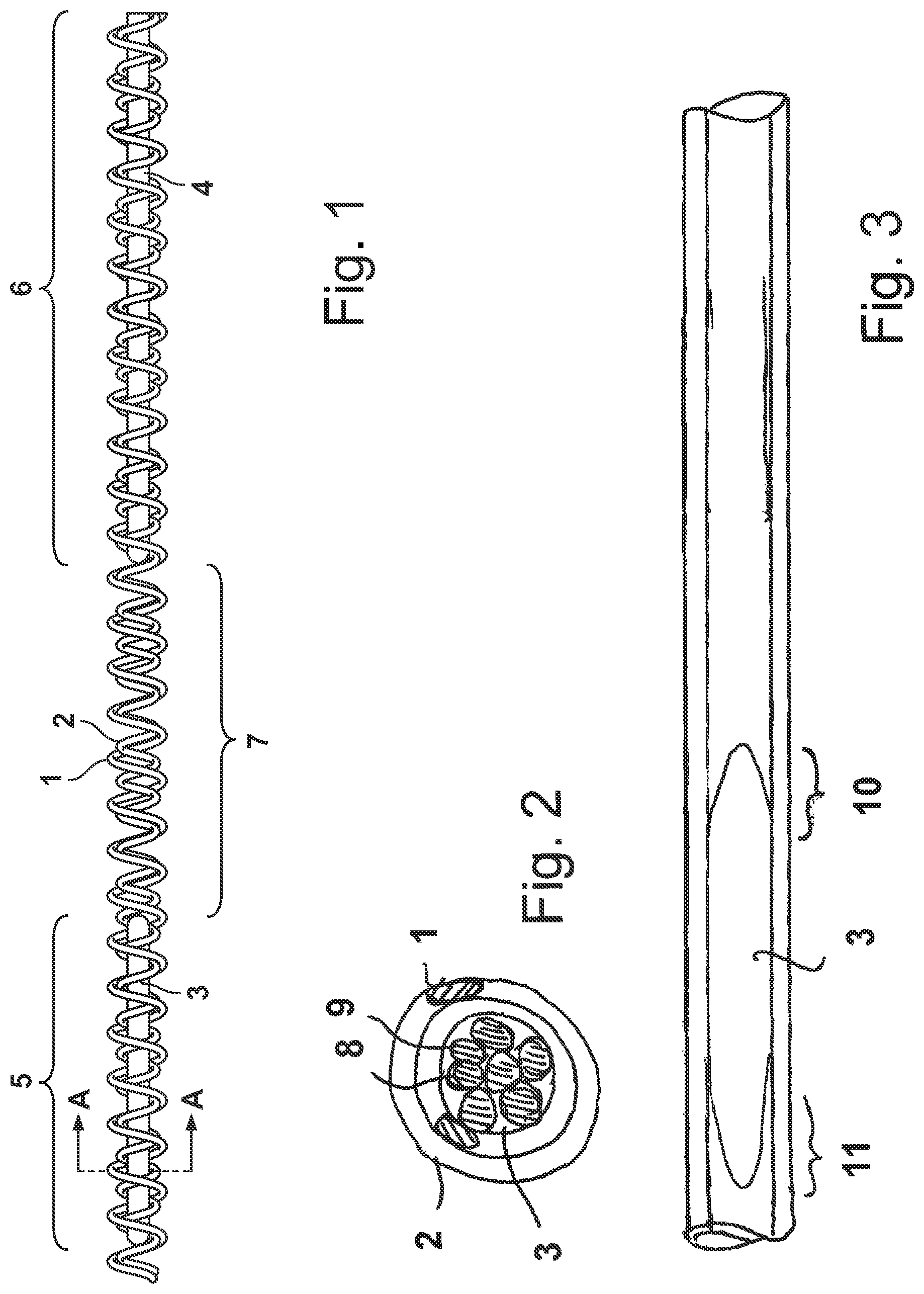 Patent US12313113 Figure 1 – Catheter pump arrangement and flexible shaft arrangement having a core