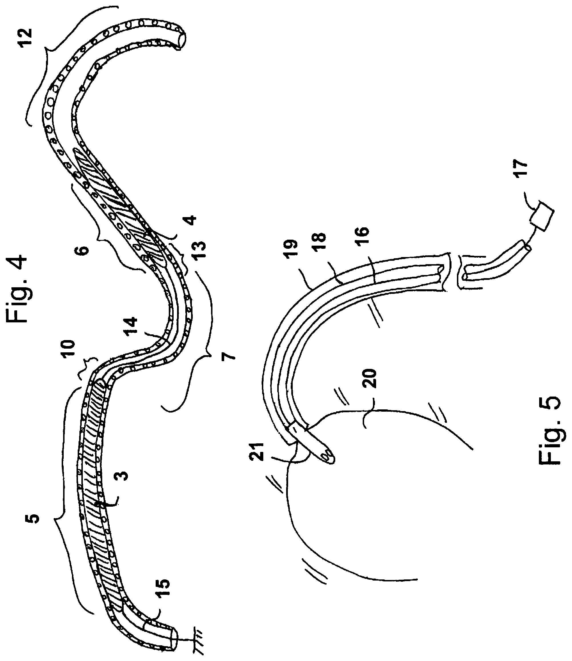 Patent US12313113 Figure 2 – Catheter pump arrangement and flexible shaft arrangement having a core