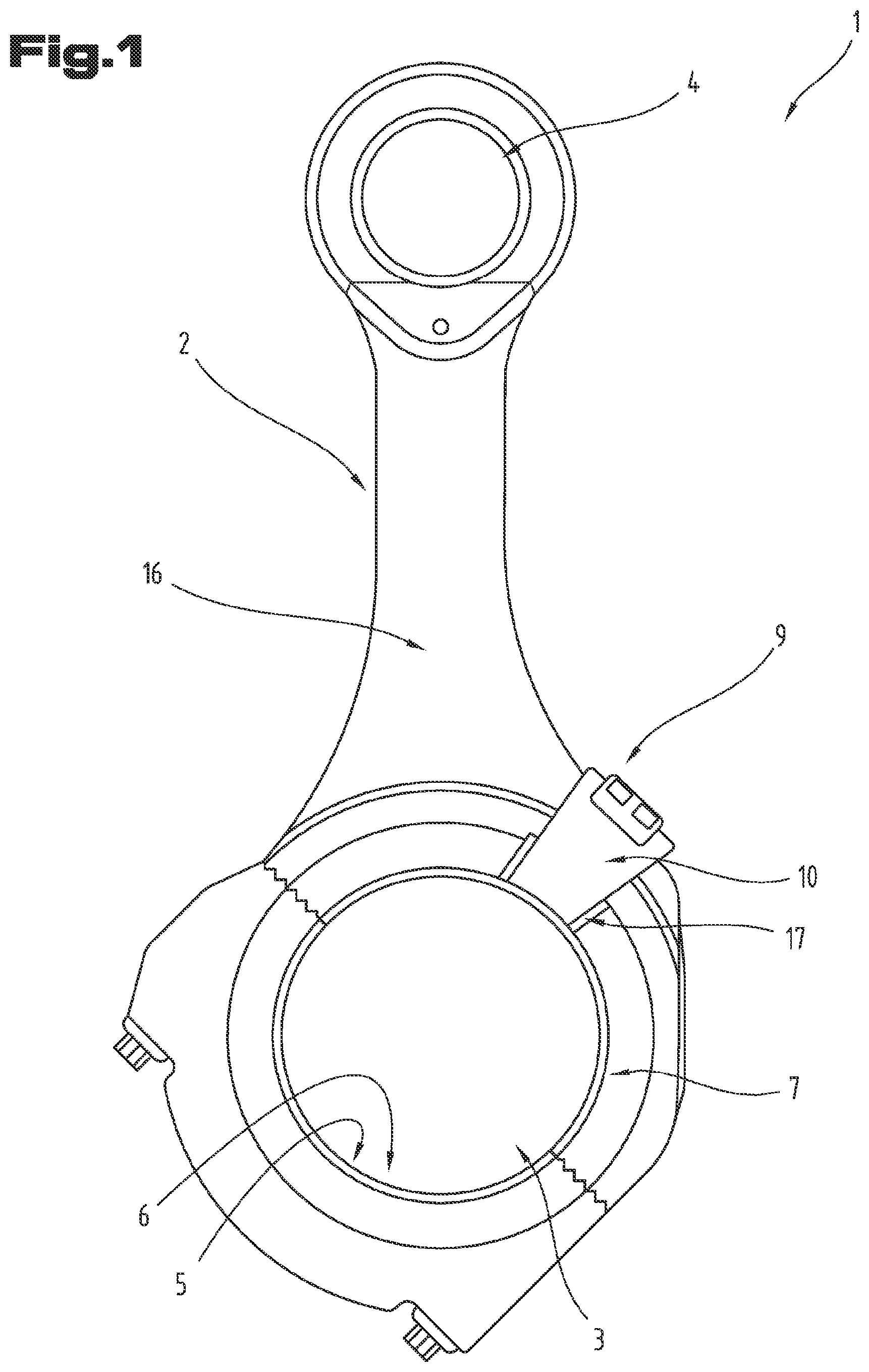 Patent US12313124 — Bearing element having a sensor and a telemetry device — Figure 1
