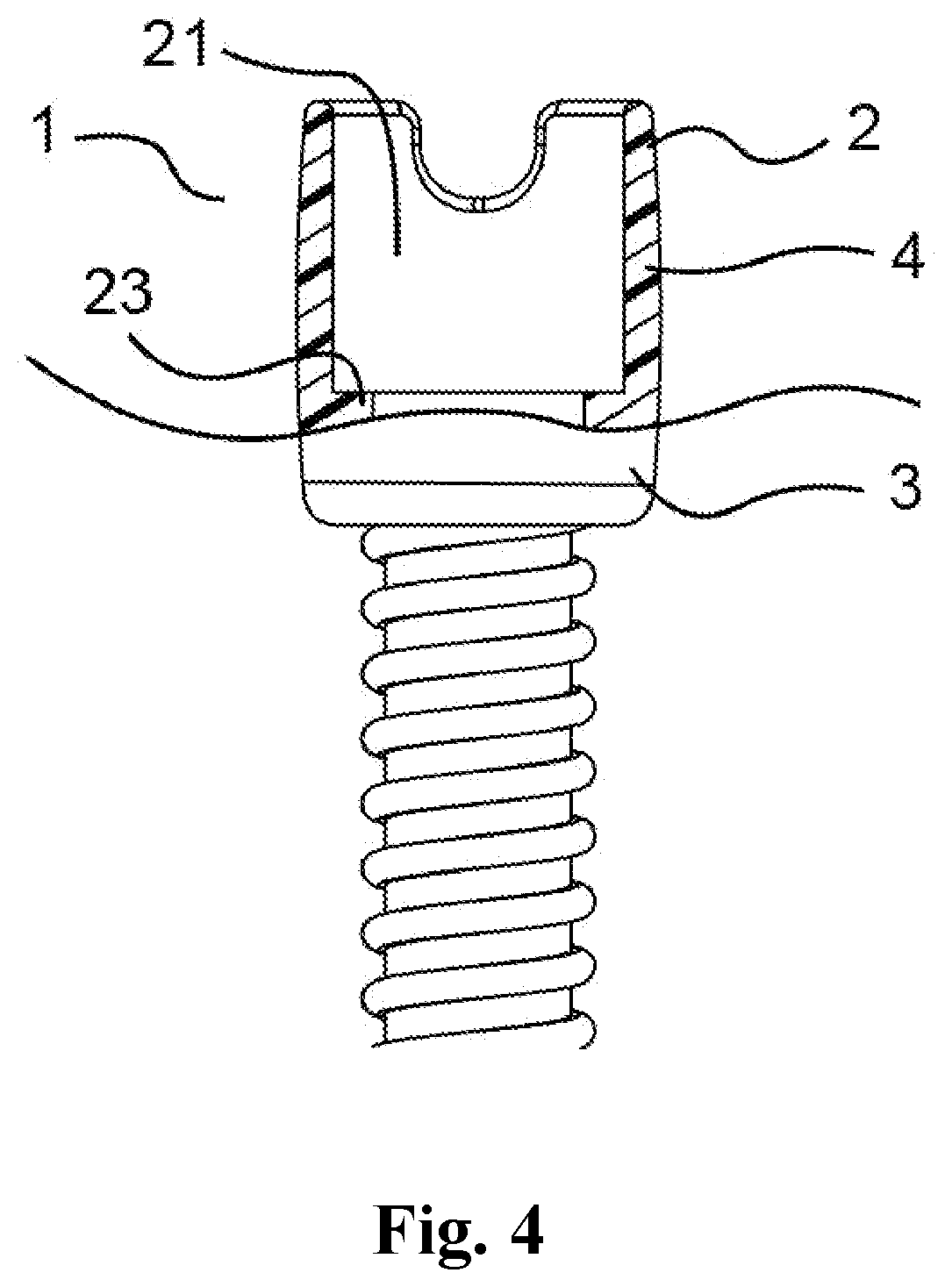 Patent US12313197 Figure 4 – Hose connector with an adjustment structure
