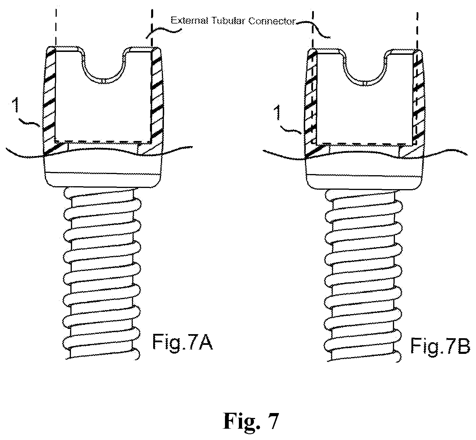 Patent US12313197 Figure 7 – Hose connector with an adjustment structure