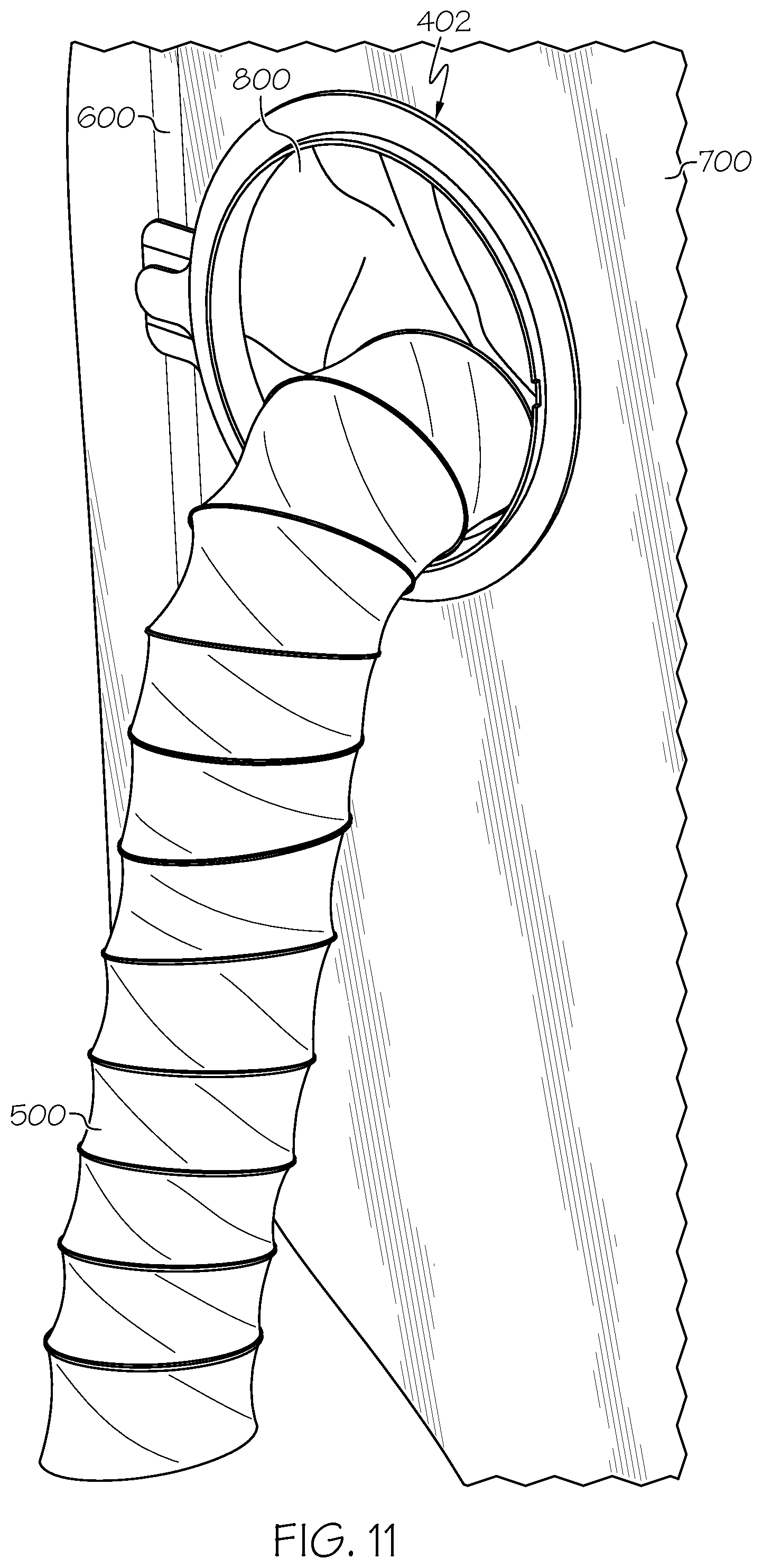 Patent US12313201 Figure 12 – Flexible air duct systems and methods of installation and use thereof