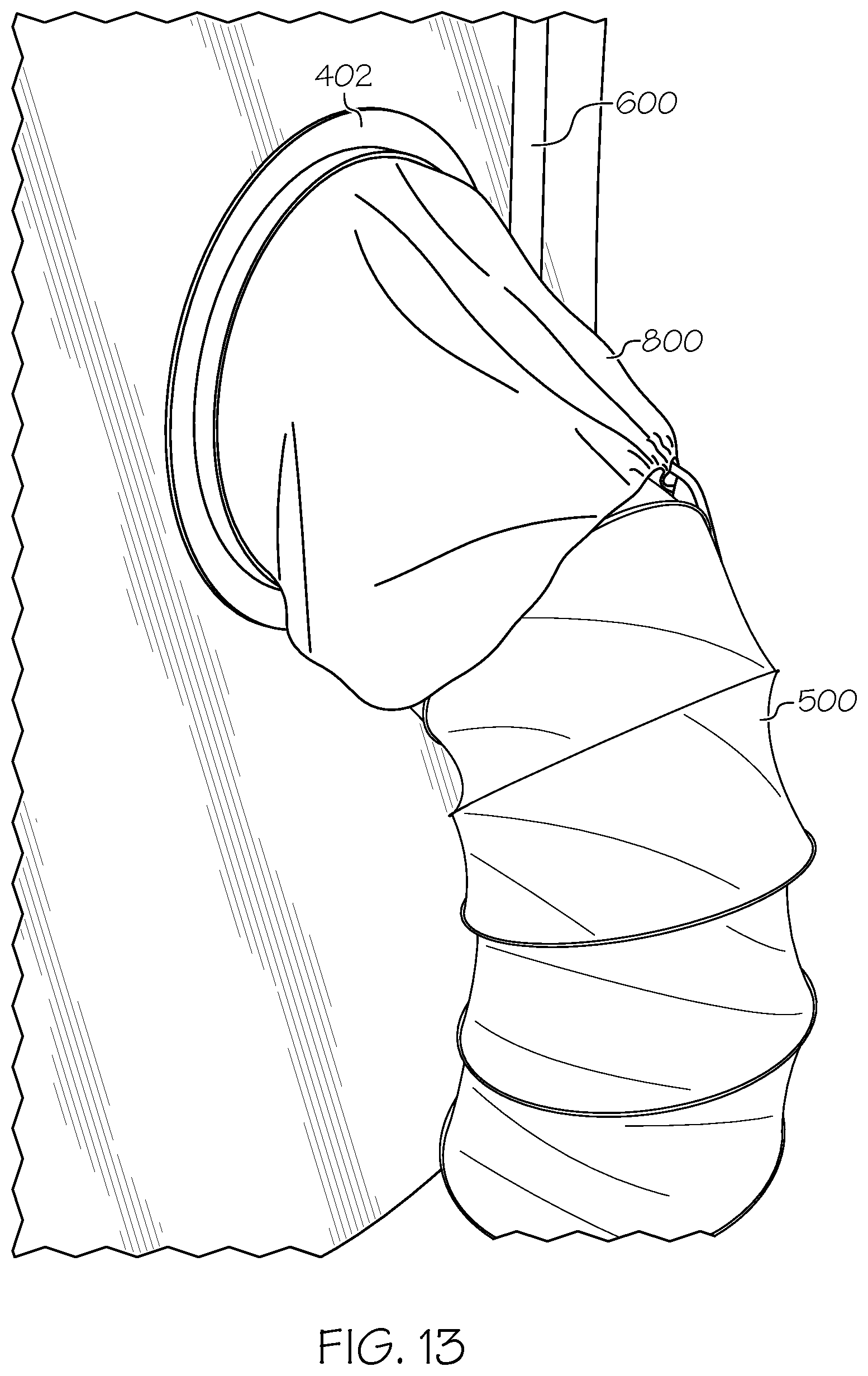 Patent US12313201 Figure 14 – Flexible air duct systems and methods of installation and use thereof